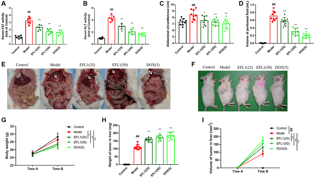 Protective effect of EFL1 in mice underwent breast cancer-surgical hepatic implantation (SHI). (A, B) Serum levels of liver enzymes aspartate aminotransferase. (AST) and alanine aminotransferase (ALT) were determined using commercial kits. n = 6. (C) Abdominal circumference from surgical hepatic implantation (SHI) mice after 2 weeks of EFL treatment. n = 9. (D) Peritoneal fluid volume was measured after 2 weeks of EFL1 treatment. n = 9. (E) Representative images of liver metastasis and mesenteric re-metastasis in SHI mice. White arrows denote SHI tumor and red arrows denote mesenteric re-metastasis. (F) Representative images of tumor growth in mice received SHI. (G) Body weights recorded right before SHI surgery (Time A) and after 2 weeks of EFL1 administration (Time B). n = 9. (H) Liver tumor weight at the end of the experiment. n = 9. (I) Liver tumor volume recorded right before SHI surgery (Time A) and after 2 weeks of EFL1 administration (Time B). n = 9. Data were compared using one-way ANOVA with Dunnett’s post hoc (A–D, H) or two-way ANOVA with Tukey’s post hoc (G, I). ##P *P **P 