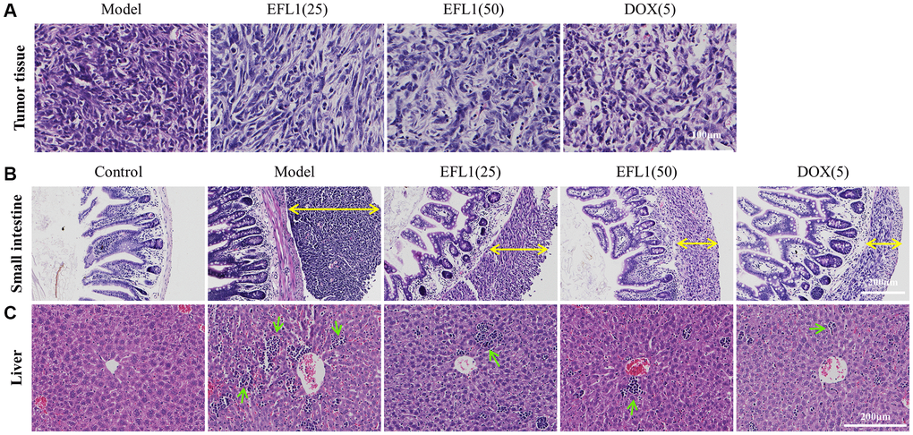 Representative histology sections stained with H&E. (A) Representative pictures of liver tumor sections. Scale bars: 100 μm. (B) Representative pictures of small intestine sections. Yellow double arrows denote tumor size. Scale bars: 200 μm. (C) Representative pictures of liver sections. Green arrows denote inflammatory cells. Scale bars: 200 μm.