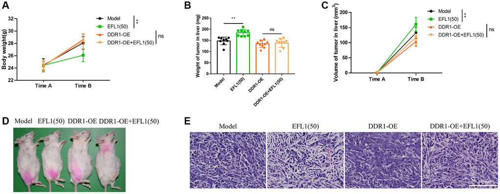 Body weight and tumor characterization following DDR1 overexpression. (A) Body weights were recorded right before SHI surgery (Time A) and after 2 weeks of EFL1 administration (Time B). n = 9. (B) Liver tumor weight at the end of the experiment. n = 9. (C) Liver tumor volume was recorded right before SHI surgery (Time A) and after 2 weeks of EFL1 administration (Time B). n = 9. (D) Representative images of tumor bearing mice at the end of the experiment. (E) Representative histology of H&E stained tumor sections from experimental groups. Data were compared using two-way ANOVA with Tukey’s post hoc. **P 