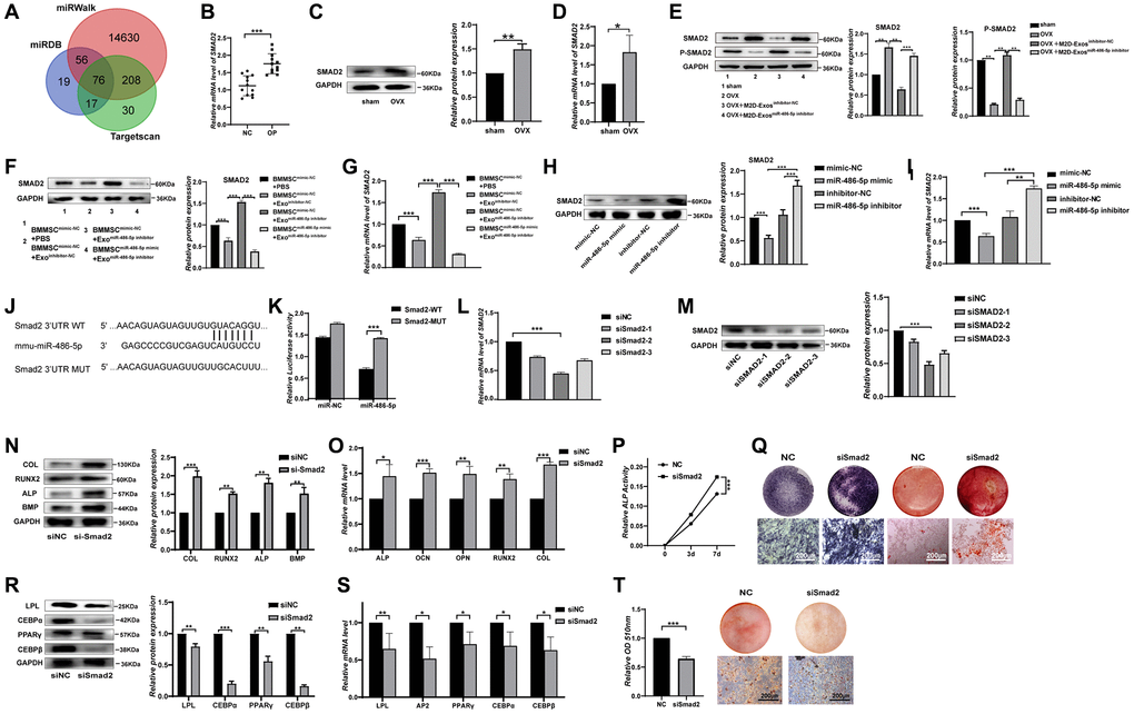 SMAD2 was the target of miR-486-5p. (A) TargetScan, miRDB, and miRWalk were used to predict gene targets of miR-486-5p. (B) mRNAs were extracted from bone specimens collected from female patients with osteoporosis (OP) and female subjects without osteoporosis (NC). SMAD2 mRNA expression was measured by qRT-PCR. (C, D) The expression of SMAD2 in bone tissues of OVX mice with osteoporosis and sham-operated control counterparts was measured by Western blots and qRT-PCR. (E) Western blot analysis was used to detect the expression of SMAD2 and p-SMAD2 in sham, OVX+PBS, OVX+M2D-Exosinhibitor-NC, and OVX+M2D-ExosmiR-486-5p inhibitor mice. (F, G) Western blots and qRT-PCR analysis were used following treatment with PBS, M2D-Exosinhibitor-NC, or M2D-ExosmiR-486-5p inhibitor to assess SMAD2 expression in mimic NC- or miR-486-5p-transfected BMMSCs. (H, I) Western blot and qRT-PCR analysis of SMAD2 levels in BMMSCs after treatment with mimic-NC, miR-486-5p mimic, inhibitor-NC, or miR-486-5p inhibitor for 48 h. (J) Schematic illustration of the design of luciferase reporters containing the WT SMAD2 3′UTR or the site-directed mutant SMAD2 3′UTR. (K) The wild-type (WT) or mutant-type (MUT) constructs were inserted into the psiCHECK-2 reporter vector. Luciferase activity was measured in the lysates, and the values were normalized to that of the psiCHECK-2 vector. (L, M) The knockdown efficiency of three SMAD2 siRNAs was confirmed by qRT-PCR and Western blot analysis. (N, O) Western blots and qRT-PCR were used to analyse osteogenic-specific markers after SMAD2 knockdown. (P) An ALP activity assay was performed to analyse ALP activity on days 0, 3, and 7. (Q) ALP staining was performed on day 14, and Alizarin red staining showed increased calcification on day 21 after SMAD2 knockdown. Scale bars, 200 μm. (R, S) Western blots and qRT-PCR were used to analyse adipogenic-specific markers after SMAD2 knockdown. (T) Oil red O staining and extraction were performed to detect the formation of lipid droplets on day 10 of adipogenic differentiation. Scale bars, 200 μm. Data are expressed as the mean ± SEM, *p **p ***p 