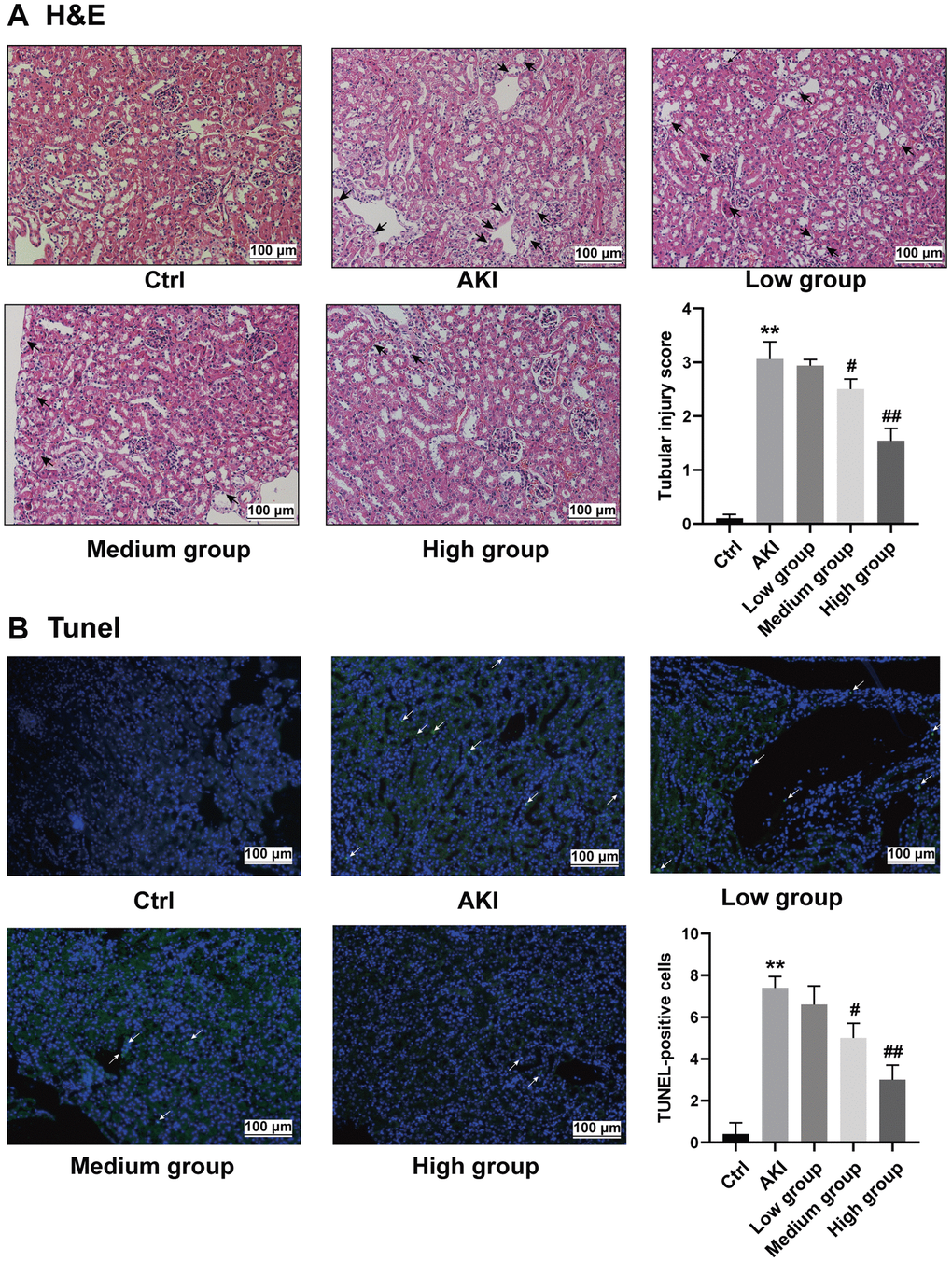 Reversal of renal pathological injury and reduced apoptosis in AKI mice by DHGC. (A) Representative histology and pathological tubular injury score in the renal cortex by H-E staining (200×, arrows represent renal tubular epithelial injury). (B) Apoptosis was also evaluated by TUNEL staining and quantification of TUNEL-positive cells (200×, arrows indicate the apoptosis-positive area).