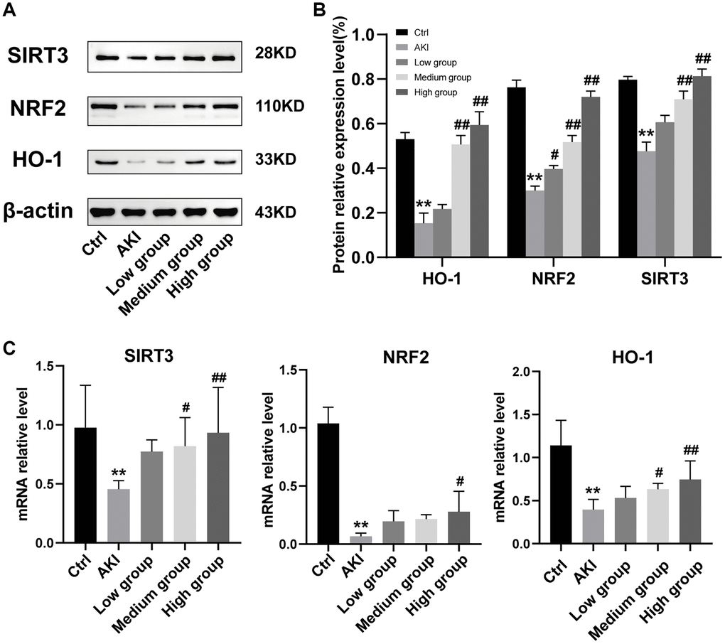 Expression of the SIRT3/NRF2/HO-1 signaling pathway. (A) Representative images of the effect of DHGC on the SIRT3/NRF2/HO-1 signaling pathway in AKI mice by Western blot. (B) Statistical analysis of the results of the Western blot. (C) Expression of SIRT3, NRF2, and HO-1 in kidney tissues at mRNA level. Data are presented as the mean ± SD. **P #P ##P 