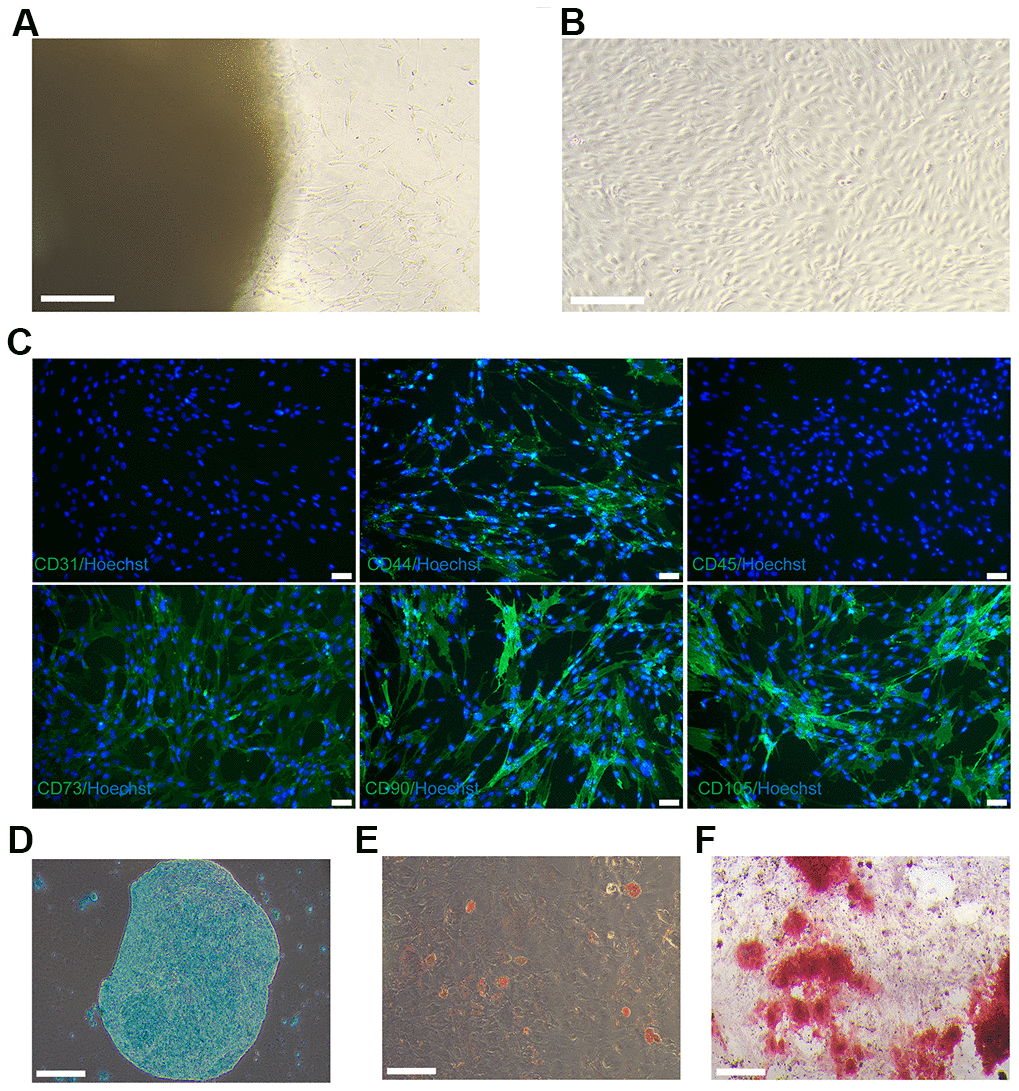 Culture and identification of hUC-MSCs. (A) On day 12, hUC-MSCs migrated from the Wharton’s jelly tissue. Scale bar=200 μm. (B) Images of long-scaled hUC-MSCs cultured for the fifth passage. Scale bar=200 μm. (C) Immunofluorescence staining of hUC-MSCs with surface markers CD44, CD73, CD90, and CD105 (green fluorescence). Hoechst 33342 (blue) was utilized to stain the nucleus of hUC-MSCs. Scale bar=50 μm. (D) Toluidine blue staining was used to detect the ability of hUC-MSCs to differentiate into chondrocytes. Scale bar=200 μm. (E) Oil red O staining was used to detect the ability of hUC-MSCs to differentiate into adipocytes. Scale bar=200 μm. (F) Alizarin red S staining was utilised to test the capacity of hUC-MSCs to differentiate into osteoblasts. Scale bar=200 μm.