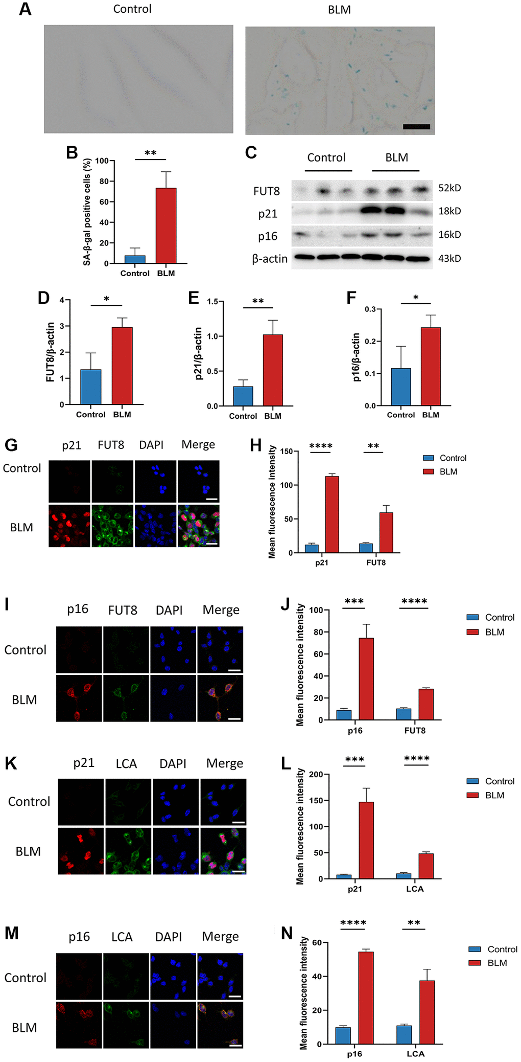 CF modifications accompanying AECs senescence in pulmonary fibrosis. (A, B) SA-β-gal staining shows representative images of MLE12 cells after 72 hours of BLM treatment. Scale bar, 10μm. Data were presented as the mean ± SD. **P t-test). (C–F) Western blotting using anti-FUT8, anti-p21, anti-p16, and anti-β-actin antibodies in MLE12 cells treated with BLM or saline. The grayscale evaluations of the bands were adjusted to be equal to β-actin. Data were presented as the mean ± SD. *P t-test). **P t-test). (G–J) Representative immunofluorescence shows colocalization of p21WAF1 or p16ink4a (Red) and FUT8 (Green) in MLE12 cells. DAPI was used to counterstain the nuclei. Scale bar, 25 μm. Data were presented as the mean ± SD. **P t-test). ***P t-test). ****P t-test). (K–N) Immunofluorescence shows colocalization of p21WAF1 or p16ink4a (Red) and LCA (Green) in MLE12 cells treated with BLM. DAPI was used to counterstain the nuclei. Scale bar, 25 μm. Data were presented as the mean ± SD. **P t-test). ***P t-test). ****P t-test).