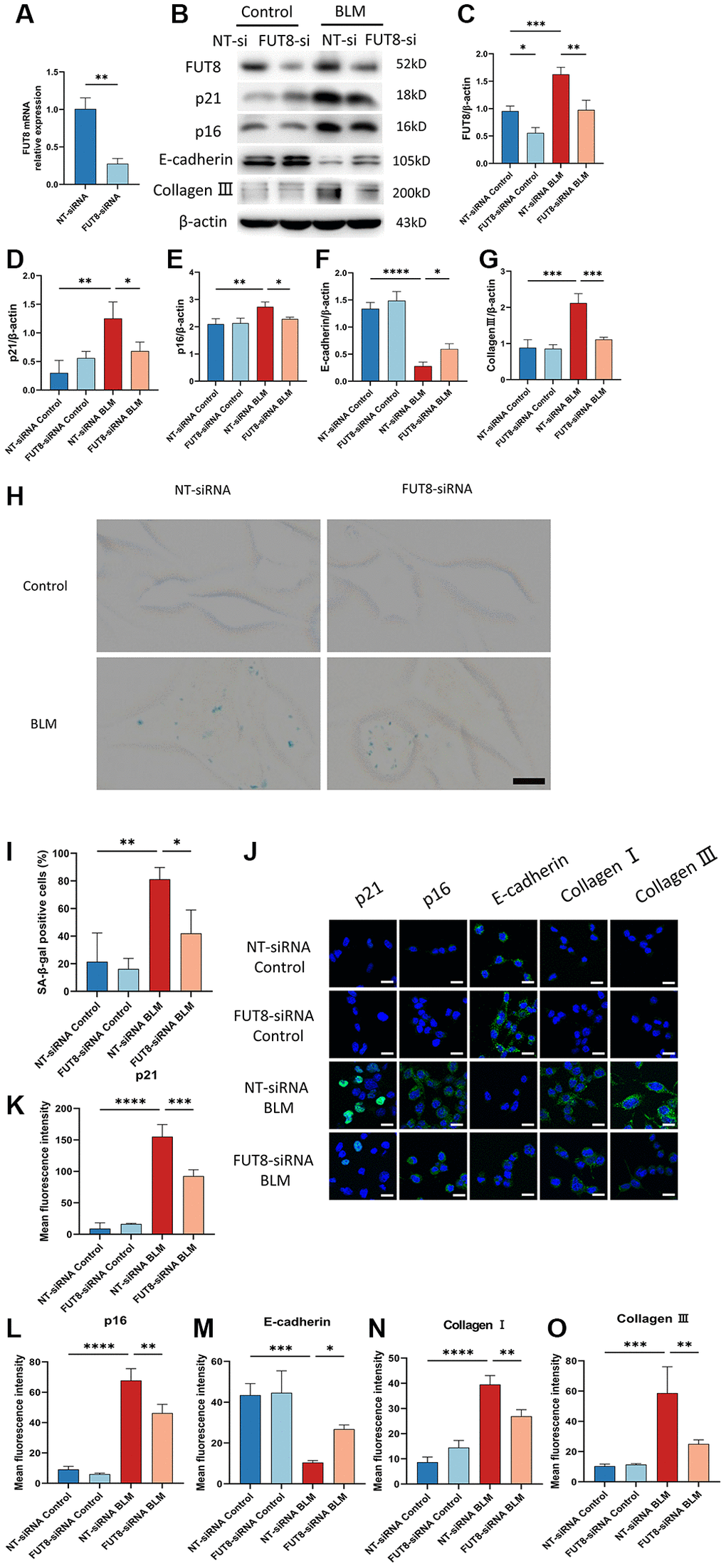 Silencing CF modifications with FUT8 siRNA rescues AECs from senescence and attenuates BLM-induced lung fibrosis. NT siRNA or FUT8 siRNA was used to transfect MLE12 cells, which were subsequently treated or untreated with BLM for 48 hours. (A) To test the gene silencing effect, we use real-time polymerase chain reaction (RT-PCR) to show FUT8 mRNA expression in MLE12 cells transfected with NT siRNA or FUT8 siRNA. **P t-test). (B–G) Western blotting using anti-FUT8, anti-p21, anti-p16, anti-E-cadherin, anti-collagen III, and anti-β-actin antibodies in MLE12 cells treated in different ways. Densitometric analyses of the bands were adjusted to be equal to β-actin. Data were presented as the mean ± SD. *P **P ***P ****P H, I) SA-β-gal staining reveals indicative pictures of different treated MLE12 cells. Scale bar, 10 μm. Data were presented as the mean ± SD. *P **P J–O) E-cadherin, p21WAF1, p16ink4a, collagen I, and collagen III expressions were measured via the immunofluorescence technique. Scale bar 25 μm. Data were presented as the mean ± SD. *P **P ***P ****P 