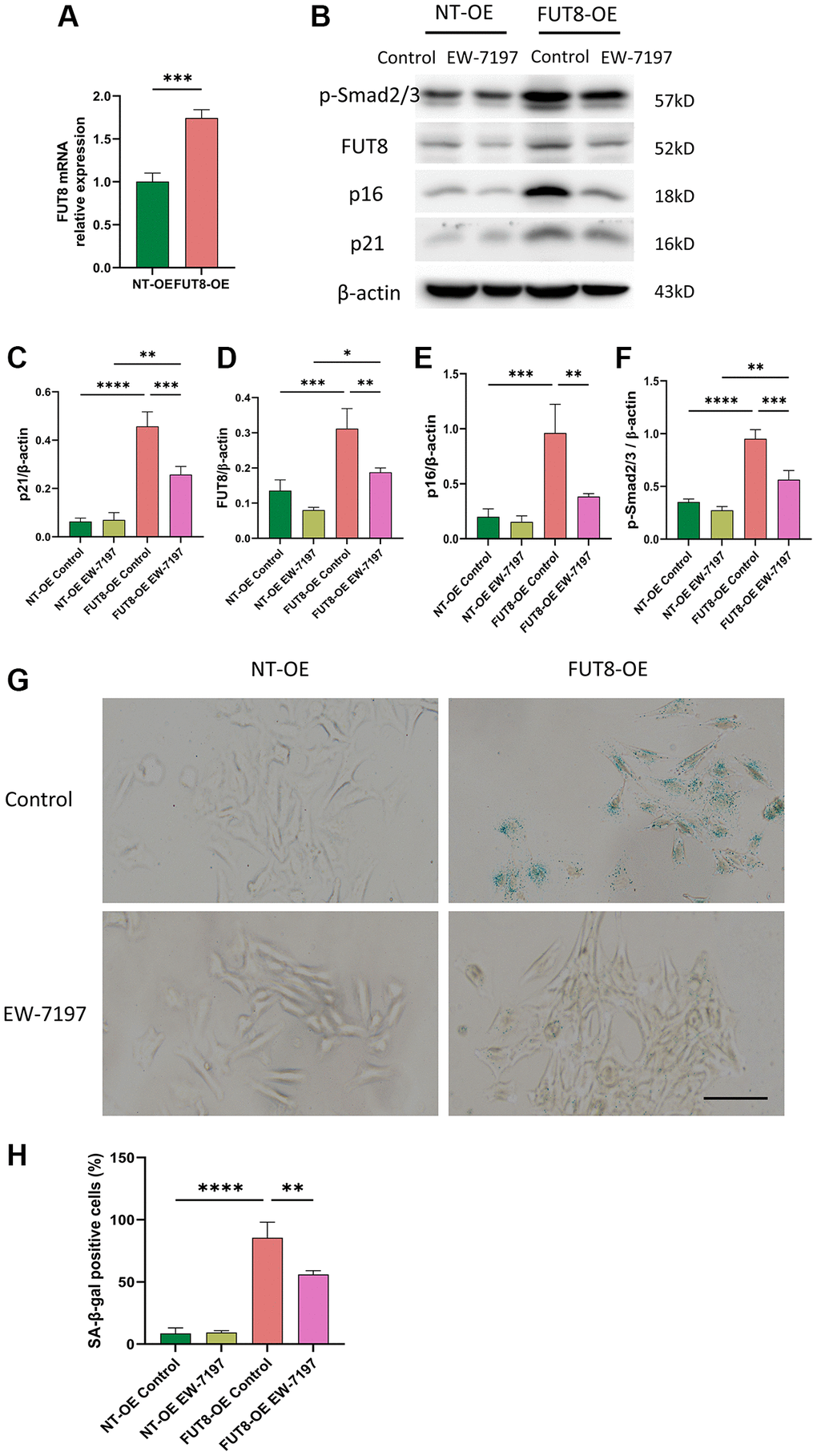 Inhibition of TGF-βR I activity with EW-7197 abrogates overexpression of CF modification induced AECs senescence. MLE12 cells were infected with an adenovirus expression vector overexpressing FUT8 and then stimulated with EW-7197 for 6 hours. (A) To test the effect of gene overexpression, we used RT-PCR to show FUT8 mRNA expression in MLE12 cells infected with FUT8-OE or NT-OE. ***P t-test). (B–F) Western blotting using anti-p-Smad2/3, anti- FUT8, anti-p16, anti-p21 and anti-β-actin antibodies. Densitometric analyses of the bands were adjusted to be equal to β-actin. Data were presented as the mean ± SD. *P **P ***P ****P G, H) SA-β-gal staining shows indicative pictures. Scale bar, 100 μm. Data were presented as the mean ± SD. **P ****P 