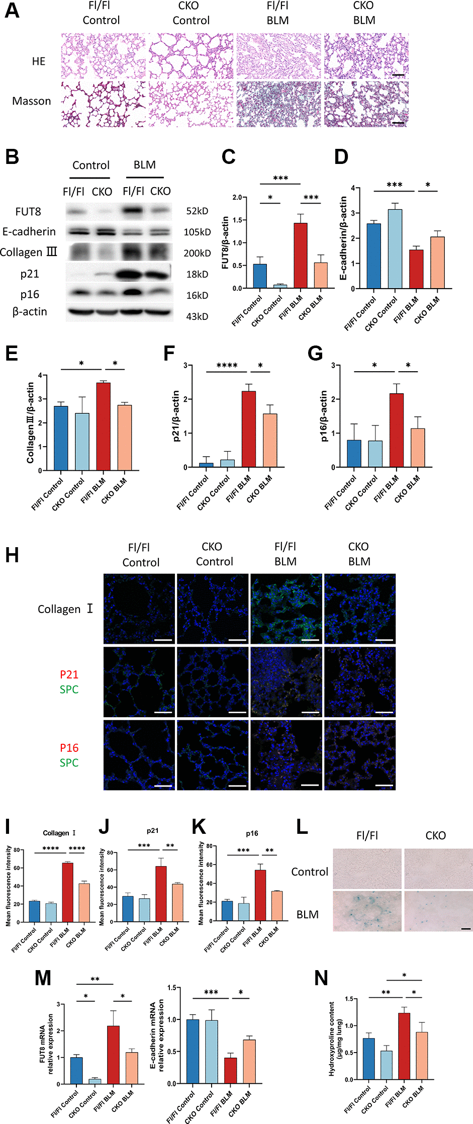 CKO mice inhibit BLM-induced cellular senescence and ameliorate lung fibrosis in vivo. (A) CKO mice and Fl/Fl mice were treated with BLM for 21 days. HE and Masson staining reveal representative images of different lung tissue sections. Scale bar, 100 μm. (B–G) Western blotting using anti-FUT8, anti-E-cadherin, anti-collagen III, anti-p21, anti-p16, and anti-β-actin antibodies. Densitometric analyses of the bands were adjusted to be equal to β-actin. Data were presented as the mean ± SD. *P ***P ****P H–K) The protein levels of collagen I in different mice were measured via immunofluorescence technique. Representative immunofluorescence shows colocalization of p21WAF1 or p16ink4a (Red) and SPC (Green) in the lung tissue of different mice. Scale bar 50 μm. Data were presented as the mean ± SD. **P ***P ****P L) SA-β-gal staining reveals indicative pictures of different lung tissue sections. Scale bar, 100 μm. (M) RT-PCR revealed FUT8 and E-cadherin mRNAs expression in different groups. Data were presented as the mean ± SD. *P **P ***P N) Hydroxyproline content of lung tissues. Data were presented as the mean ± SD. *P **P 