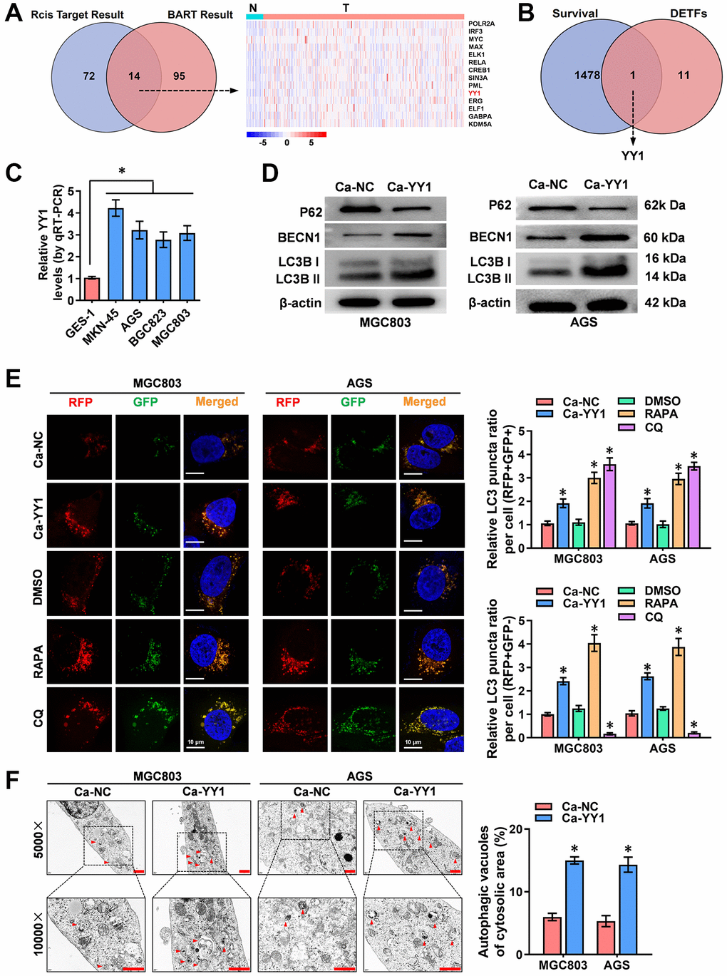 YY1 is upregulated and promotes autophagy in cancer. (A) Venn diagram indicating overlapped genes from two publicly available bioinformatics analyses. The right panel shows gene expression features in cancer and adjacent tissues from the Xena platform. (B) Overlapping analysis (Venn diagram) revealing the 12 TFs with survival-related genes. (C) qRT-PCR analysis showing the expression of YY1 in GC cell lines. (D) Western blotting displaying the expression of autophagy-associated proteins in AGS and MGC803 cells treated with the empty vector (Ca-NC) or Ca-YY1. (E, F) Immunofluorescence staining and TEM scanning demonstrating fluorescence intensity and autophagic vacuoles in AGS and MGC803 cells treated with the empty vector (Ca-NC) or Ca-YY1, and those treated with DMSO, CQ (Chloroquine, 20 μmol/L) or RAPA (Rapamycin, 1 μmol/L) as positive controls for inactivated or activated autophagy. Scale bar: 10 μm in E and 1 μm in F. *P 