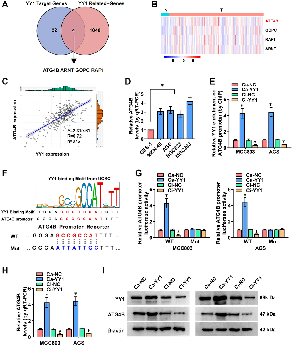 YY1 facilitates ATG4B expression. (A) The analysis of the overlap (Venn diagram) between YY1 target genes and YY1-related genes revealing the four targets involved in the YY1 regulation of autophagy-related genes. (B) Heatmap showing the expression features of those four genes in GC and adjacent normal tissues from the Xena platform. (C) A correlation test validating the association between ATG4B and YY1 on the Xena platform. (D) qRT-PCR assay displaying the expression levels of ATG4B in GC and GES-1 cells. (E) ChIP assay unveiling YY1 enrichment on the ATG4B promoter in MGC803 and AGS cells stably transfected with Ca-NC, Ca-YY1, Ci-NC or Ci-YY1. (F) Schematic illustration showing the YY1 binding sites on the ATG4B promoter at -135/-121 bases from UCSC Genome Browser, and the wild-type (WT) or mutations (Mut) of ATG4B promoter reporters were designed. (G) Dual-luciferase assay disclosing the luciferase activity of ATG4B promoter in AGS and MGC803 cells stably transfected with Ca-NC, Ca-YY1, Ci-NC or Ci-YY1. (H, I) qRT-PCR and western blot assays showing the transcript and protein expression levels of ATG4B in MGC803 and AGS with YY1 overexpression or knockdown. *P 