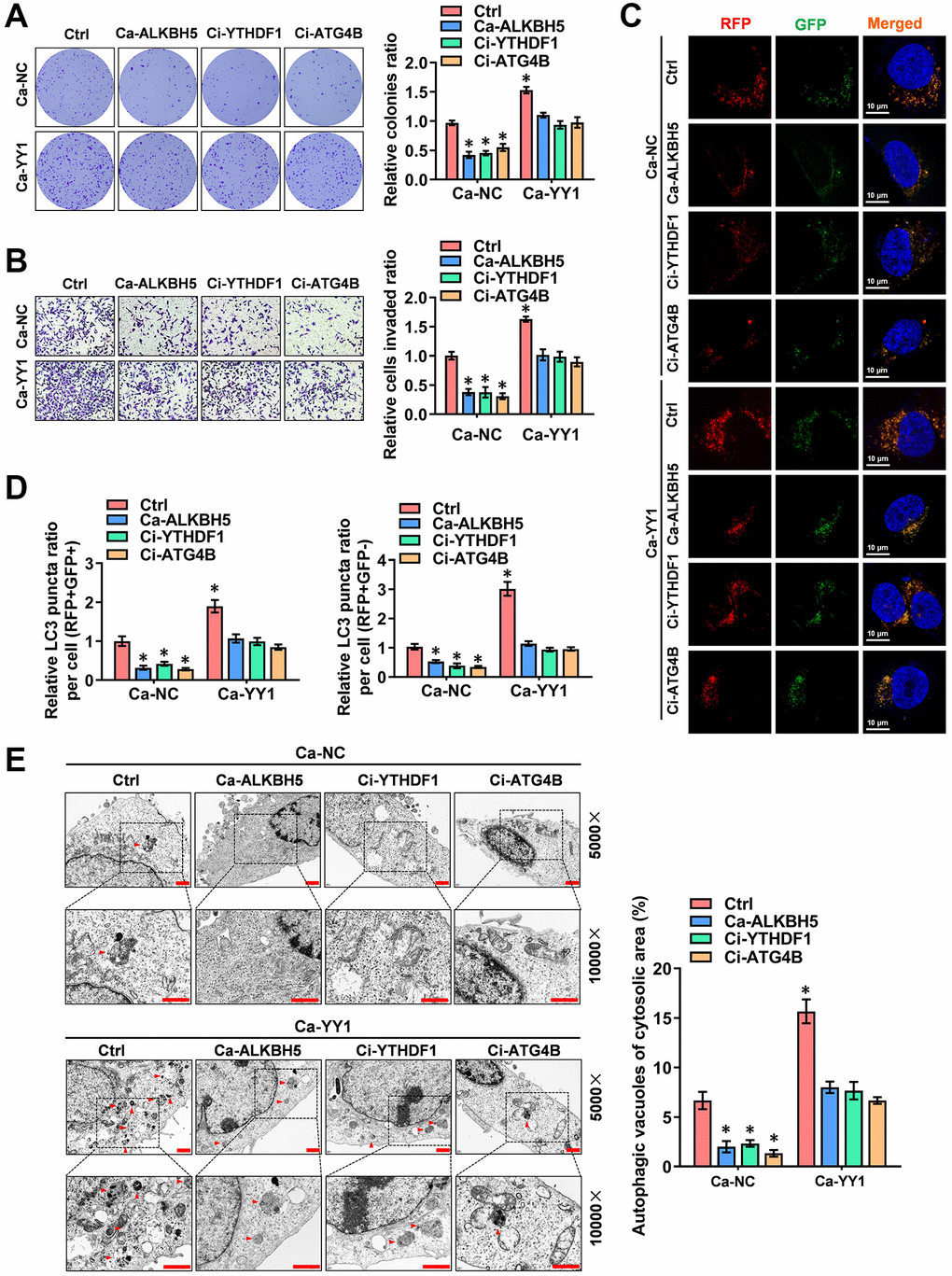 YY1 drives cancer progression and autophagy in an m6A-dependent manner. (A, B) Representative images (left) and the quantification (right) of colony formation (A) and transwell (B) assays showing the growth and migration of AGS cells transfected with Ca-NC, Ca-YY1 or co-transfected with Ca-ALKBH5, Ci-YTHDF1 or Ci-ATG4B. (C, D) Representative images (C) and quantification (D) revealing the immunofluorescence staining intensity with mRFP-GFP-LC3 in AGS cells stably transfected with Ca-NC, Ca-YY1 or co-transfected with Ca-ALKBH5, Ci-YTHDF1 or Ci-ATG4B. Red (RFP+GFP-) puncta represent autolysosomes, and yellow (RFP+GFP+) puncta represent autophagosomes. Scale bar: 10 μm. (E) Representative images from TEM scanning (left panel) and quantification (right panel) exhibiting autophagic vacuoles in AGS cells stably transfected with Ca-NC, Ca-YY1 or co-transfected with Ca-ALKBH5, Ci-YTHDF1 or Ci-ATG4B. Scale bar: 1 μm. *P 