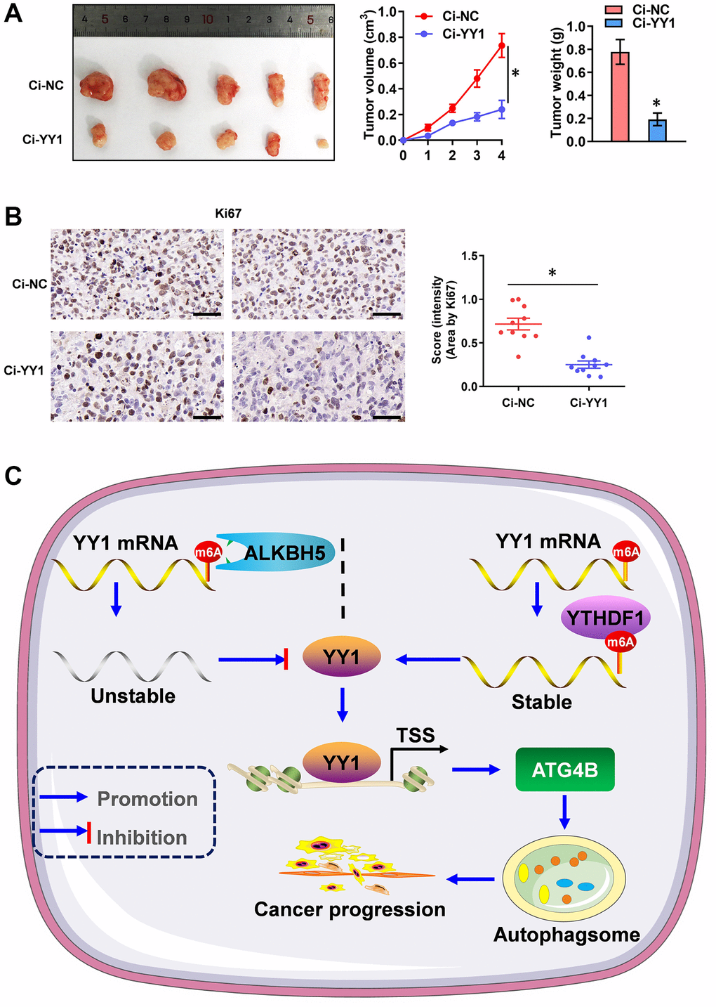 YY1 inhibition suppresses tumorigenesis in vivo. (A) Representative images, in vivo growth curve, and tumor weights of xenografts in nude mice established by the subcutaneous injection of AGS cells stably transfected with Ci-NC, Ci-YY1. (B) Representative images and IHC quantification staining showing Ki-67 protein expression in xenograft tumors. (C) Mechanisms underlying YY1-promoted autophagy and GC progression. *P 