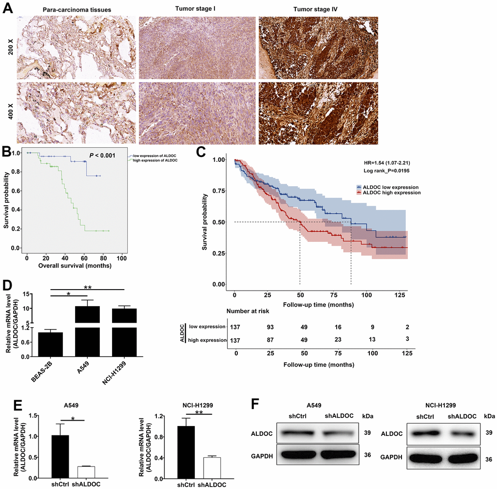 ALDOC is strongly expressed in NSCLC. (A) ALDOC protein patterns were detected in NSCLC tissues compared with normal samples through IHC staining. (B) Kaplan-Meier analysis revealed the relationship between ALDOC level and patients’ overall survival. (C) Association between high ALDOC expression and poorer survival outcomes in patients with NSCLC using GEO database. (D) ALDOC mRNA levels were quantified in BEAS-2B, A549 and NCI-H1299 cells. (E, F) After infecting shALDOC and shCtrl, ALDOC mRNA and protein levels in A549 and NCI-H1299 cells were evaluated through qRT-PCR (E) and western blot experiments (F). ** P P 