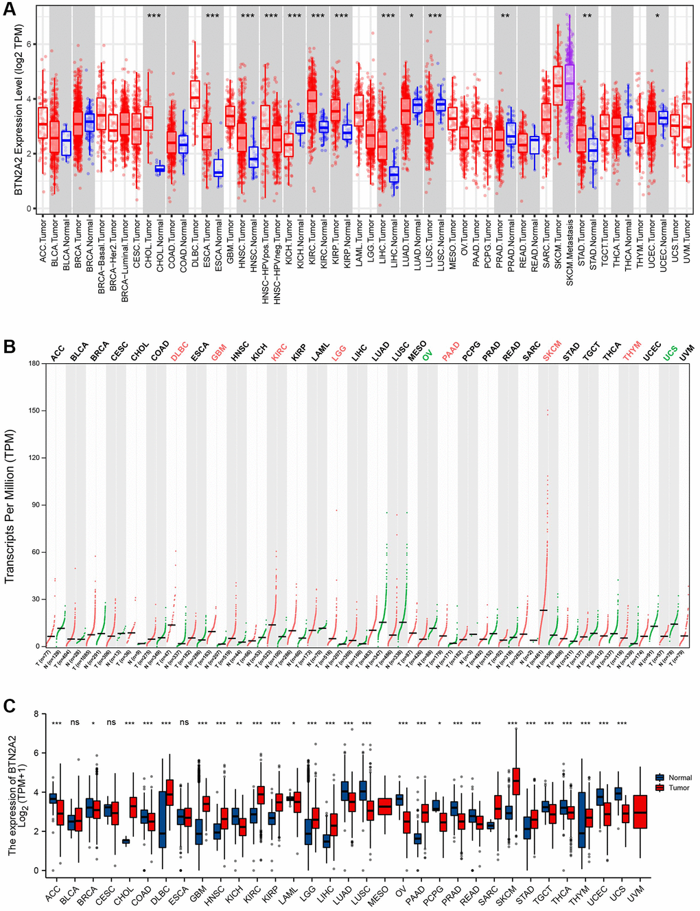 BTN2A2 expression in patients with cancer. (A) BTN2A2 expression in pan-cancer using TIMER. (B) BTN2A2 expression in pan-cancer using GEPIA 2. (C) BTN2A2 expression in pan-cancer using TCGA. Abbreviations: ACC: Adrenocortical carcinoma; BRCA: Bladder Urothelial carcinoma; CESC: Cervical squamous cell carcinoma and endocervical adenocarcinoma; DLBC: Lymphoid Neoplasm Diffuse Large B-cell Lymphoma; LAML: Acute Myeloid Leukemia; LUSC: Lung squamous cell carcinoma; MESO: Mesothelioma; PAAD: Pancreatic adenocarcinoma; PCPG: Pheochromocytoma and Paraganglioma; READ: Rectum adenocarcinoma; SARC: Sarcoma; TGCT: Testicular Germ Cell Tumors; THYM: Thymoma; UCS: Uterine carcinosarcoma; UVM: Uveal Melanoma; BLCA: Bladder urothelial carcinoma; CHOL: Cholangiocarcinoma; COAD: Colon adenocarcinoma; ESCA: Esophageal carcinoma; HNSC: Head and neck squamous cell carcinoma; KICH: Kidney Chromophobe; KIRP: Kidney renal clear cell carcinoma; KIRC: Kidney renal clear cell carcinoma; LIHC: Liver hepatocellular carcinoma; LUAD: Lung adenocarcinoma; PRAD: Prostate adenocarcinoma; SKCM: Skin Cutaneous Melanoma; STAD: Stomach adenocarcinoma; THCA: Thyroid carcinoma; UCEC: Uterine corpus endometrial carcinoma. *P **P ***P 