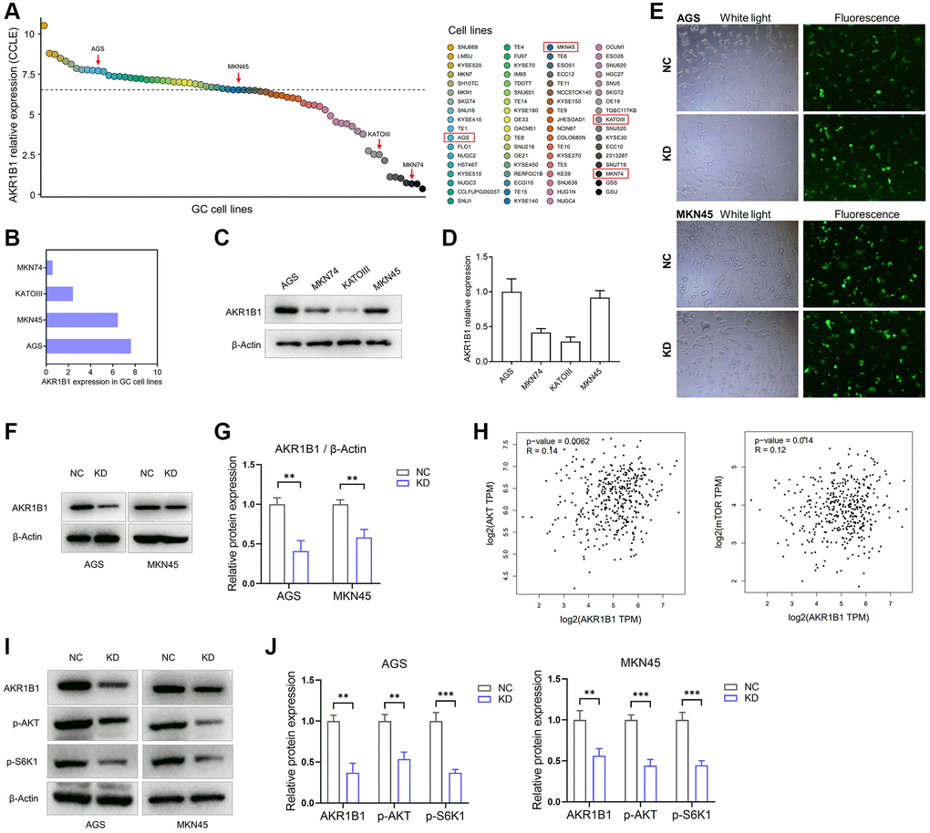 AKR1B1-KD cells were constructed, and the regulatory relationship between AKR1B1 and AKT-mTOR pathway was evaluated. (A) The AKR1B1 expression in GC cell lines was searched from the CCLE platform. (B) The CCLE platform helped select AKR1B1 expression in four GC cell lines. (C) AKR1B1 expression in four GC cell lines was detected using western blotting. (D) The immunoblot result of AKR1B1 expression was semi-quantified in four GC cell lines with ImageJ. (E) The white and fluorescence microscope images of AGS and MKN45 cells were transfected with control-shRNA (NC) and AKR1B1-shRNA (KD). (F) Western blot indicates the AKR1B1 protein levels in NC and AKR1B1-KD AGS and MKN45. (G) The immunoblot results were semi-quantified using ImageJ. (H) The GEPIA platform was used to determine the correlation analysis of AKR1B1 and AKT or mTOR gene expression levels in GC patients from TCGA datasets. (I) Western blot reveals the AKR1B1, p-AKT, p-S6K1, and β-actin protein levels in AKR1B1-KD GC cells. (J) The immunoblot results of AGS were semi-quantified using ImageJ. Abbreviations: CCLE: Cancer Cell Line Encyclopedia; NC: negative control; KD: AKR1B1-shRNA. **P ***P 