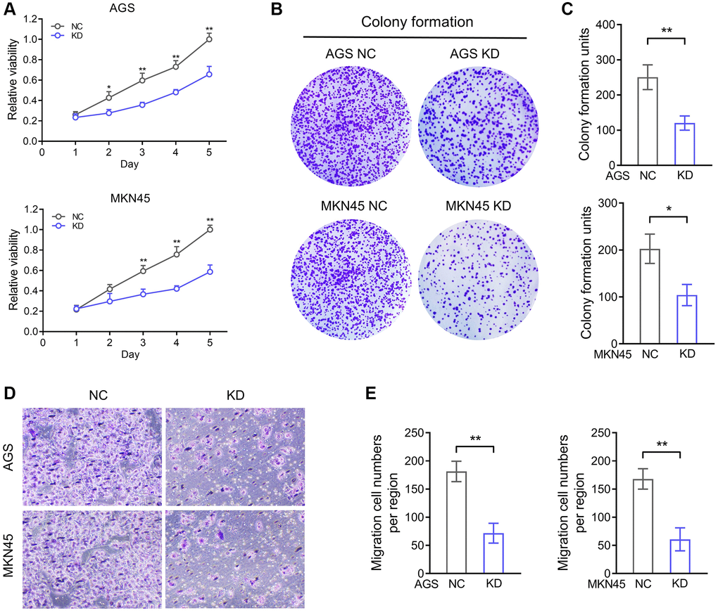 AKR1B1 enhances the proliferation and migration ability of GC cells. (A) The CCK-8 assay determined the proliferation ability of AGS and MKN45 transfecting with AKR1B1-shRNA. (B) The colony formation capacity of AGS and MKN45 transfected with AKR1B1-shRNA was assessed. (C) The colony-forming units were counted. (D) The migration capacity of AGS and MKN45 transfected with AKR1B1-shRNA was assessed. (E) The number of migrating cells was counted. Abbreviations: NC: negative control; KD: AKR1B1-shRNA. *P **P 