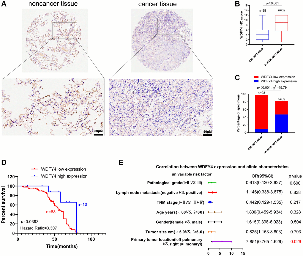 The expression and clinical significance of WDFY4 in LUAD. (A, B) Tissue microarray (TMA) analysis by IHC staining showed a low expression of WDFY4 in LUAD tissues. (C) High and low expression rates of WDFY4 in LUAD tissue. (D) Kaplan-Meier analysis showed that LUAD patients with downregulation of WDFY4 were positively correlated with worse prognosis and shorter overall survival. (E) Correlations of WDFY4 expression levels in LUAD tissues and clinicopathological features.