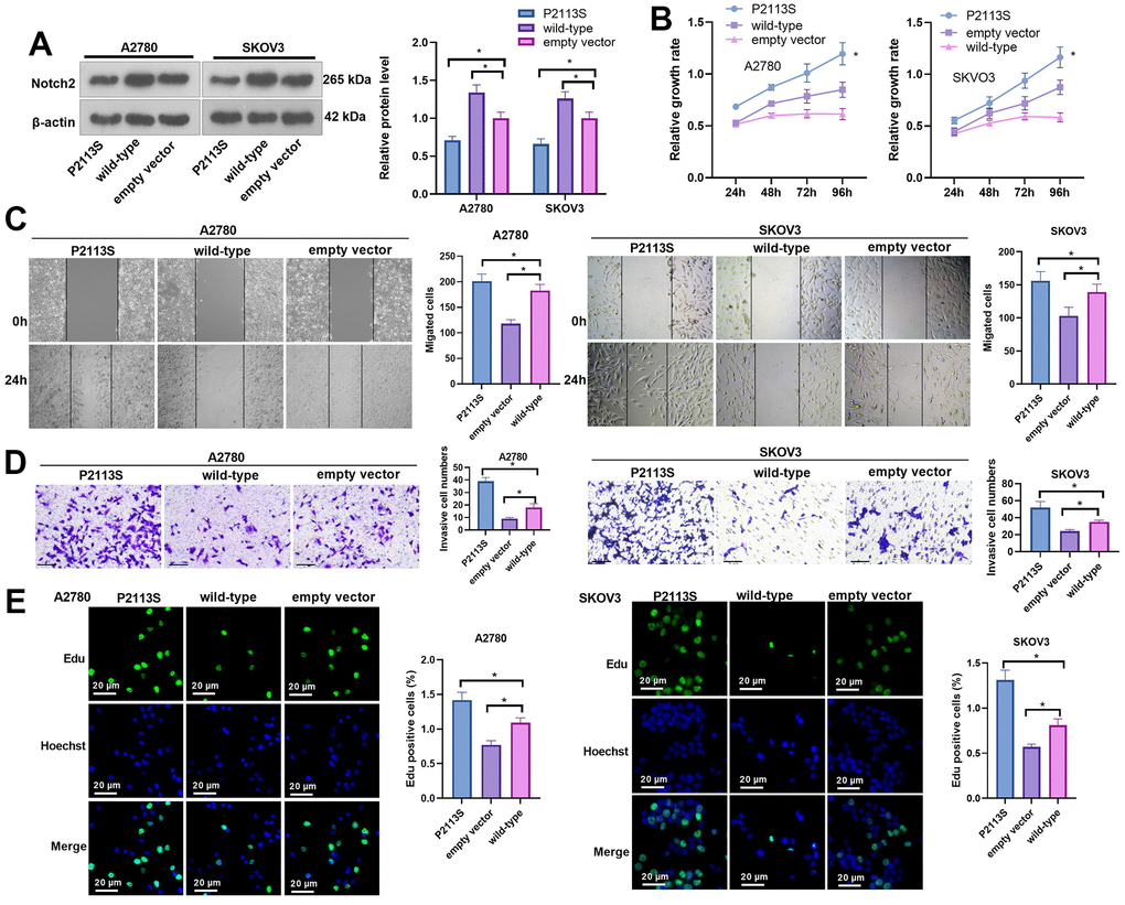 Impacts of NOTCH2 P2113S on A2780 and SKOV3 cell proliferation, migration, and invasion. (A) Notch2 level was tested following transfection with NOTCH2-P2113S in A2780 and SKOV3 cells; (B) CCK-8 assay was used for detecting cell proliferation (*pC) Scratch wound-healing assay showed alterations of cell migration. Upper panel, representative images (×100); Lower panel, quantitative analysis (*pD) Transwell chamber assay was used for evaluating cell invasion by NOTCH2 P2113S transfection. Upper panel, representative images (×100); lower panel, quantitative analysis (*pE) EdU labeling test was used for testing cell proliferation. N=3.