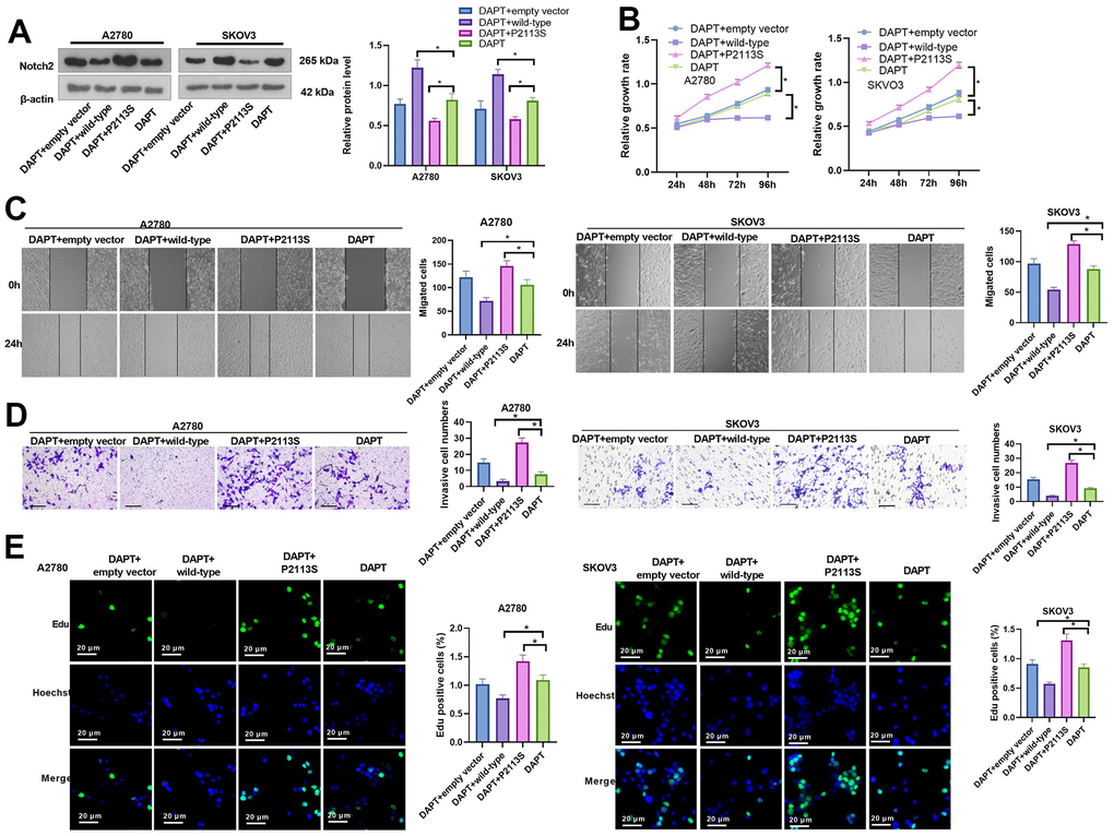 Impacts of DAPT on NOTCH2 mutated OC cells. (A) Notch2 level was tested following transfection with NOTCH2-P2113S in A2780 and SKOV3 cells; (B) CCK-8 assay was used for detecting cell proliferation (*pC) Scratch wound-healing assay showed alterations of cell migration. Upper panel, representative images (×100); Lower panel, quantitative analysis (*pD) Transwell chamber assay was used for evaluating cell invasion by NOTCH2 P2113S transfection. Upper panel, representative images (×100); lower panel, quantitative analysis (*pE) EdU labeling test was used for testing cell proliferation. N=3.