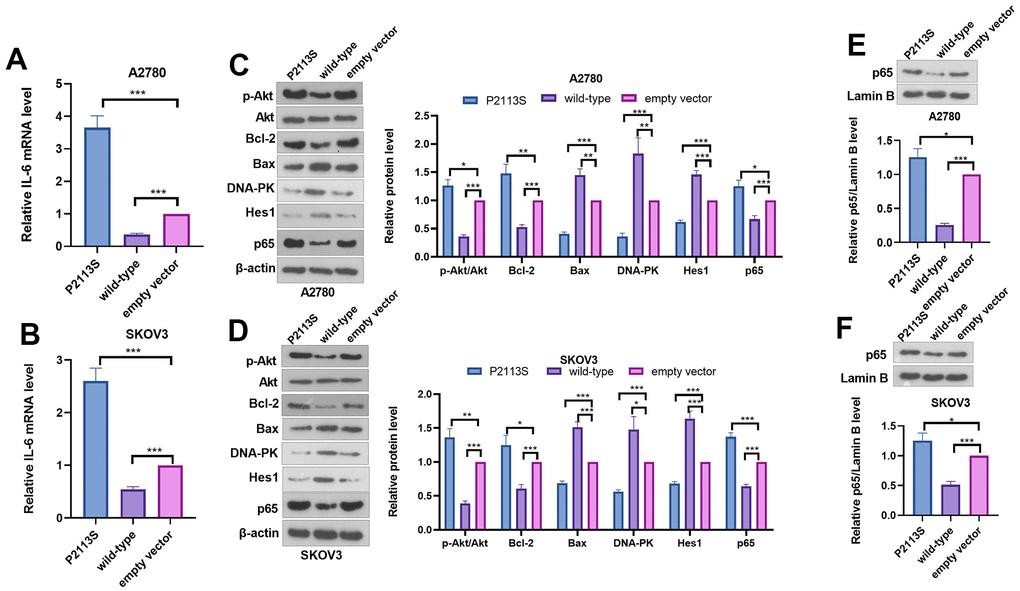 Expression of related proteins in A2780 and SKOV3 cells. (A, B) RT-PCR was used for evaluating IL-6 mRNA level. (C, D) WB analysis of p-Akt, Akt, Bcl-2, Bax, DNA-PK, Hes 1 and P65 proteins in OC cells. Each numerical value was the relative expression normalized to β-actin protein. (E, F) WB analysis of P65 proteins in the nucleus of OC cells. Each numerical value was the relative expression normalized to Lamin B protein. *p p p 