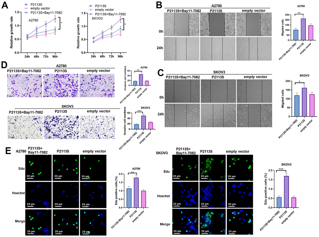 Impacts of NF-κB inhibitor Bay 11-7082 on NOTCH2 mutated OC cells. (A) CCK-8 assay was used for detecting cell proliferation (*pB, C) Scratch wound-healing assay showed alterations of cell migration. Upper panel, representative images (×100); Lower panel, quantitative analysis (*pD) Transwell chamber assay was used for evaluating cell invasion by NOTCH2 P2113S transfection. Upper panel, representative images (×100); lower panel, quantitative analysis (*pC) EdU labeling test was used for testing cell proliferation. N=3.