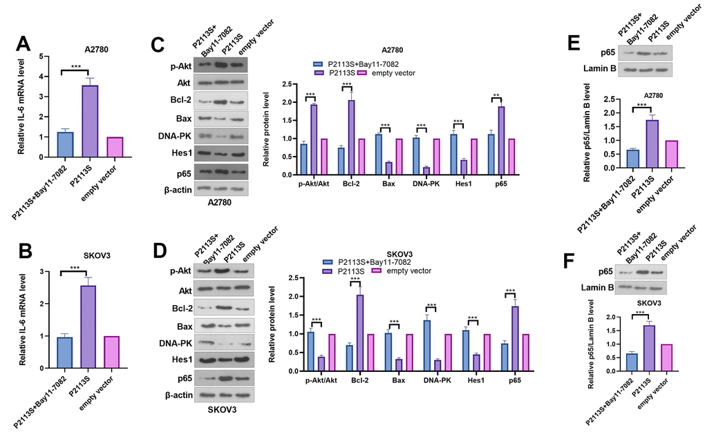 Expression of related proteins in A2780 and SKOV3 cells. (A, B) RT-PCR was used for evaluating IL-6 mRNA level. (C, D) WB analysis of p-Akt, Akt, Bcl-2, Bax, DNA-PK, Hes 1 and P65 proteins in OC cells. Each numerical value was the relative expression normalized to β-actin protein. (E, F) WB analysis of P65 proteins in the nucleus of OC cells. Each numerical value was the relative expression normalized to Lamin B protein. *p p p 