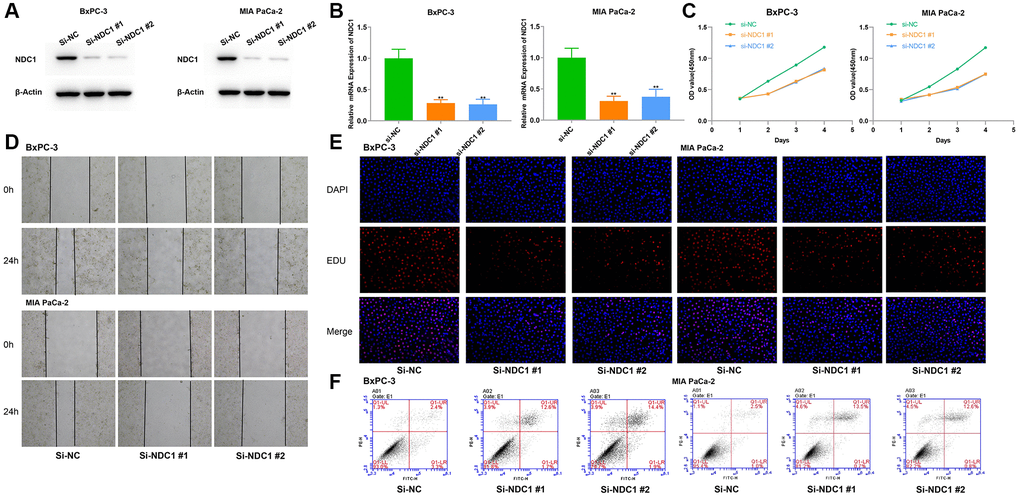 Cellular functions of NDC1 in pancreatic cancer. (A) Western blot and (B) Real-time quantitative PCR detection after siRNA mediated knockdown of NDC1 in BxPC-3 and MIA PaCa-2 cells. (C) MTT assays. (D) Scratch assays. (E) EdU assays. (F) Cell apoptosis assays. *P 