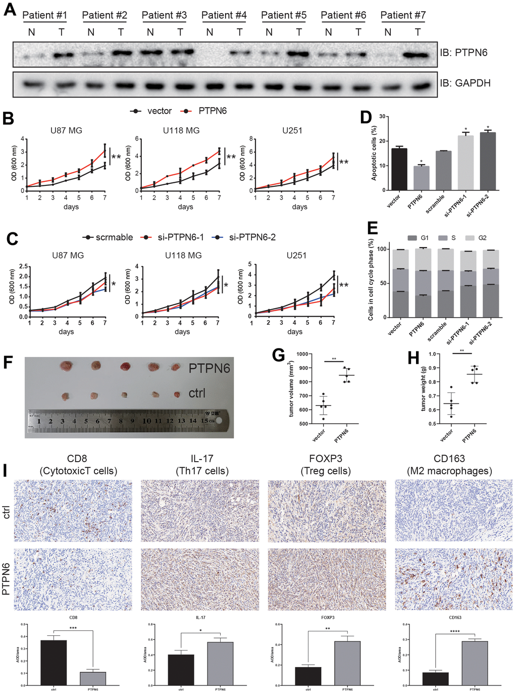 PTPN6 promotes GBM progression. (A) PTPN6 protein expression level is up-regulated in GBM human samples compared with the paired adjacent tissue. (B) PTPN6 overexpression accelerates glioma cell proliferation. (C) PTPN6 knockdown inhibits glioma cell proliferation. (D) PTPN6 overexpression inhibits glioma cell apoptosis; and promotes cell apoptosis after PTPN6 knockdown. (E) PTPN6 overexpression promotes cell cycles; and inhibits cell cycles after PTPN6 knockdown. (F) PTPN6 promotes GBM tumorigenesis in vivo. (G, H) Calculation of GBM nidus from (F), **P I) Evaluating the GBM TME in C57 mice (n = 6, biological repetition = 3). *P 