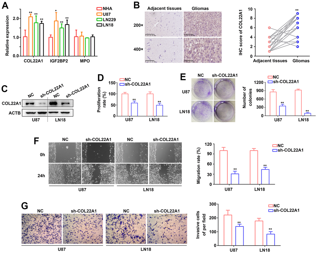 COL22A1 knockdown inhibits glioma cell proliferation and migration. (A) RT-qPCR was used to detect the expression of COL22A1, IGF2BP2, and MPO in NHA, U87, LN229, and LN18 cells. (B) IHC was used to detect the expression of COL22A1 in grade 4 diffuse gliomas and adjacent non-tumor tissues. (C) Western blotting was used to detect the expression of COL22A1 in negative control (NC) and COL22A1 knockdown cells. (D) The CCK-8 assay was used to measure proliferation in NC and COL22A1 knockdown cells. (E) Colony formation assays were used to detect tumorigenic potential of NC and COL22A1 knockdown cells. (F) Wound healing assays were used to assess migration rates in NC and COL22A1 knockdown cells. (G) Transwell assays were used to estimate invasion rates in NC and COL22A1 knockdown cells. *, P