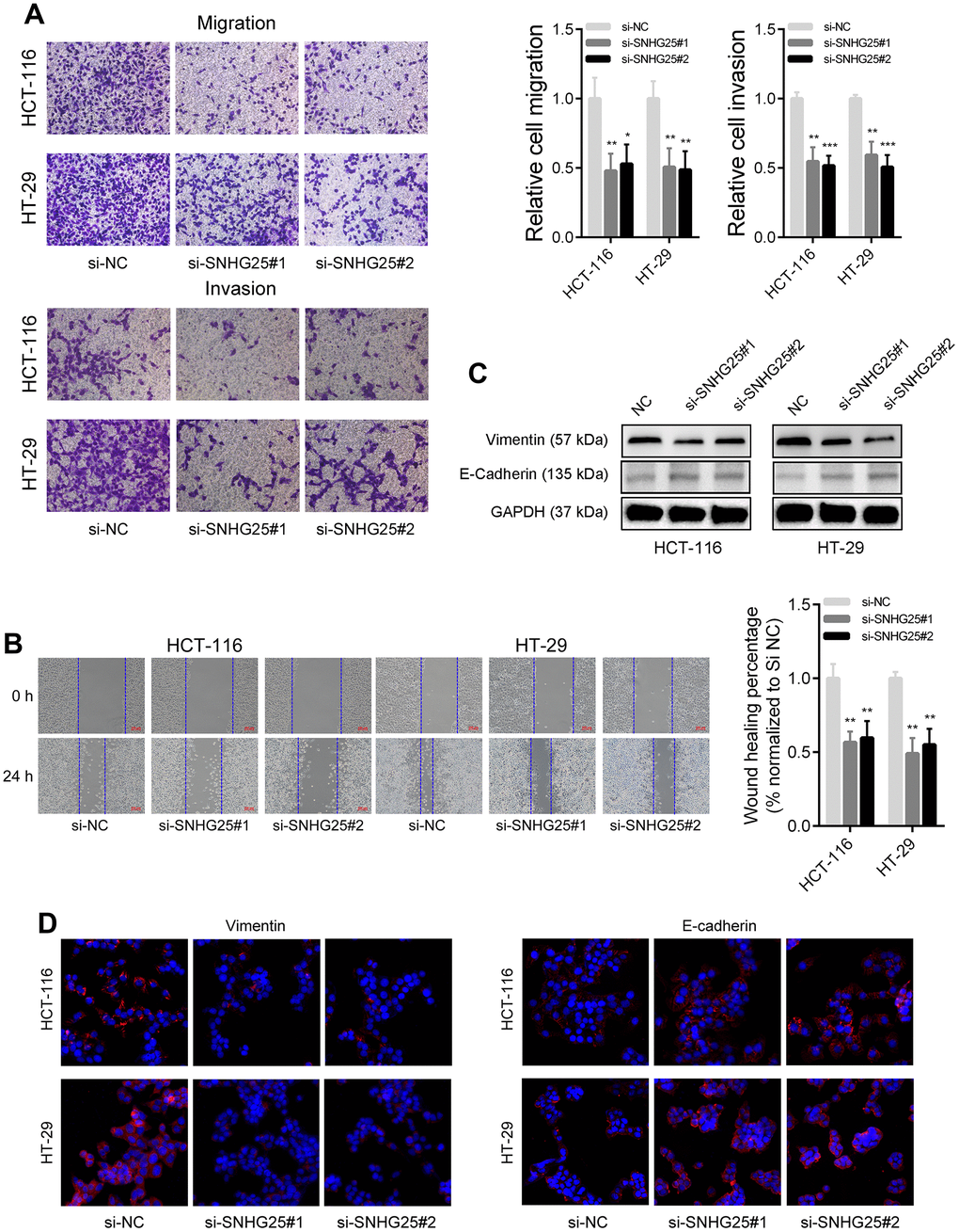 SNHG25 regulates CRC cells metastasis. (A) The migration and invasion abilities of HCT-116 and HT-29 cells were evaluated using transwell assays. (B) Representative images of wound healing assays performed using HCT-116 and HT-29 cells after SNHG25 silenced. (C) The expression of Vimentin and E-Cadherin were examined by western blot in SNHG25 knockdown HCT-116 and HT-29 cells. (D) The expression of Vimentin and E-Cadherin were detected by immunofluorescence after SNHG25 silencing. *P 