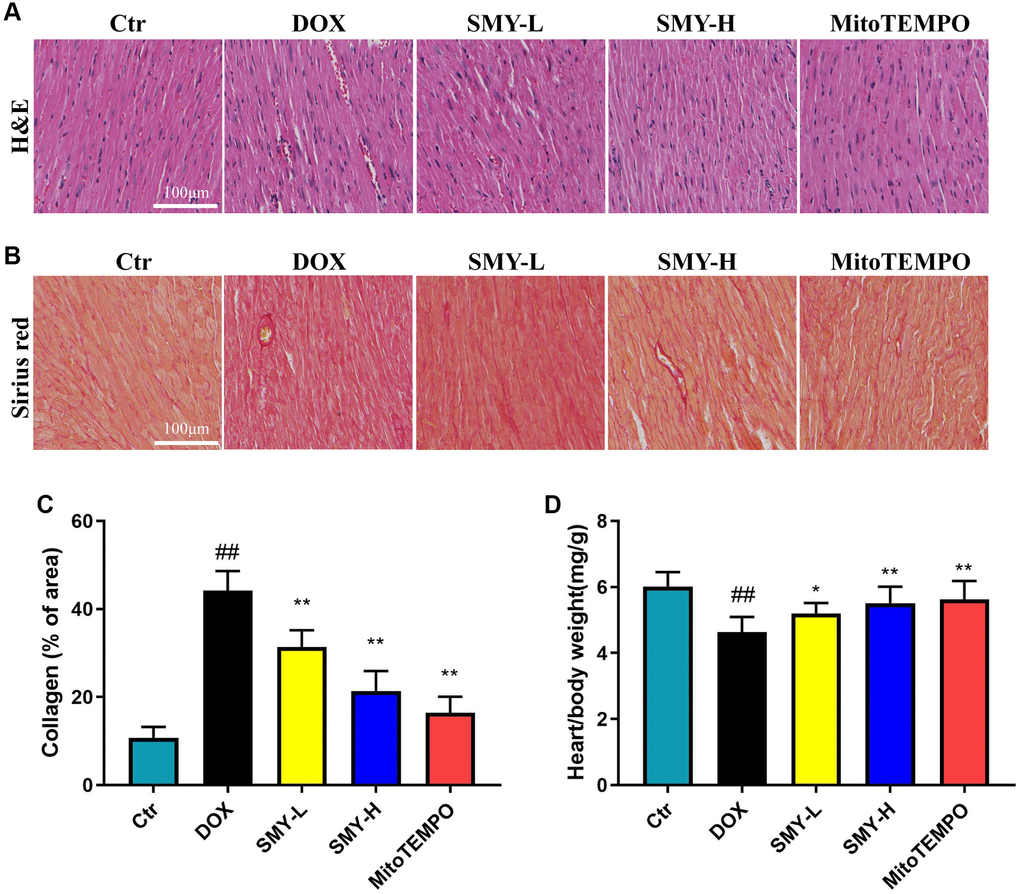 SMY prevented DOX-induced cardiomyopathy. (A, B) Cardiac sections were prepared from control mice and mice treated with DOX. SMY-L or SMY-H or mitoTEMPO were treated. The heart tissues were stained with hematoxylin and eosin (H&E, Top) or Sirius red (Bottom). (C) Cardiac collagen quantification (% of collagen of area) in heart tissue. (D) The heart/body weight ratio was calculated in control mice and mice treated with DOX with or without SMY-L or SMY-H or mitoTEMPO (n = 9 mice per group). The results were presented as mean ± SEM. ##means compared with control group, P *means compared with DOX group, P **means compared with DOX group, P 