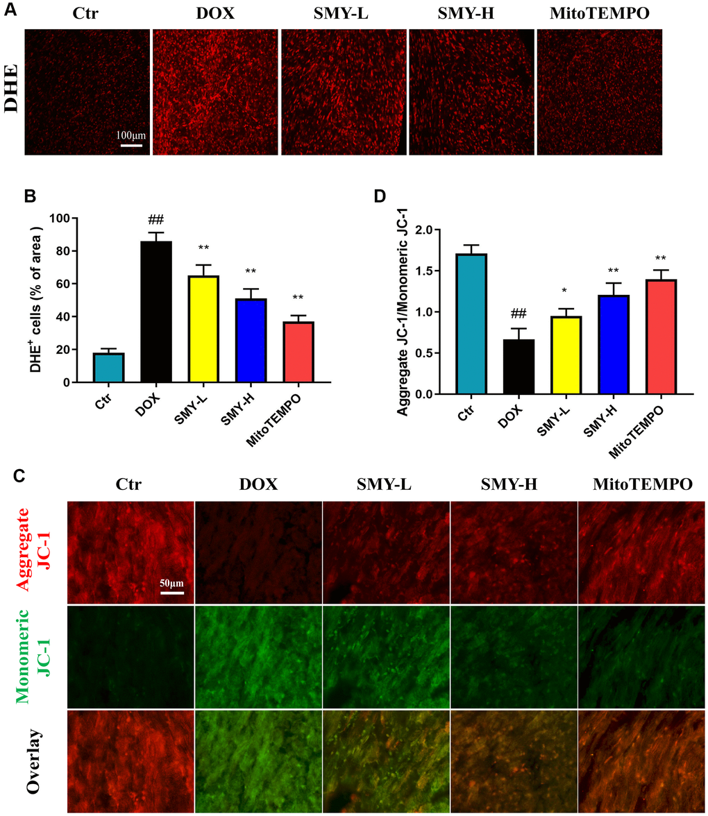 SMY scavenged ROS generation and alleviated mitochondria dysfunction. (A) Images of DHE staining of ROS. (B) Histogram showed the DHE+ cells of the area in different groups. (C) Representative images of JC-1 staining in different groups. Red fluorescence represented aggregation of JC-1, and green fluorescence represented monomeric JC-1. (D) Histogram of aggregate JC-1/monomeric JC-1. The JC-1 probe was applied to measure ΔΨm, which was expressed as the ratio of red (the aggregate form of JC-1, which denotes intact ΔΨm) to green (a monomeric form of JC-1, which signifies dissipation of ΔΨm). The results were presented as mean ± SEM. ##means compared with control group, P *means compared with DOX group, P **means compared with DOX group, P 