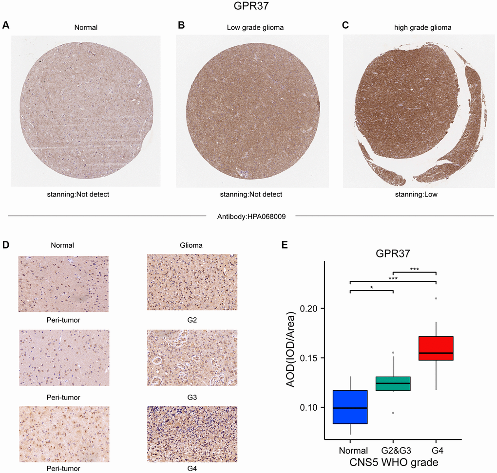 (A–C) Representative IHC images from the Human Protein Atlas showing in situ GPR37 protein expression in glioma tissues. (D, E) GPR37 expression in different grades of glioma was statistically analyzed in 38 gliomas using normal tissues adjacent to the tumor as the control group.