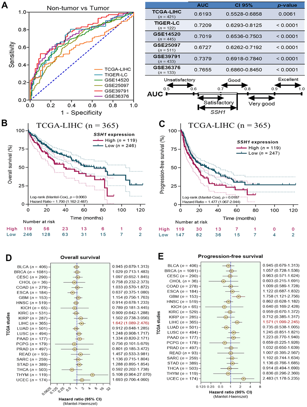 Overexpression of SSH1 is a biomarker of poor prognosis in patients with HCC. (A) Graphical representation (left) and statistical chart (right) showing the AUCs of TCGA-LIHC, TIGER-LC, GSE14520, GSE25097, GSE39791, GSE36376 of the non-tumor vs tumor samples. Kaplan-Meier plots of the (B) overall survival, and (C) progression-free survival in patients with high or low SSH1 expression from the TCGA-LIHC cohort. Forest plots of the (D) overall survival, and (E) progression-free survival based on SSH1 expression-based hazard ratios in patients with HCC from 23 different cancer types of the TCGA. All data are presented as means ± standard deviations of at least three independent experiments.