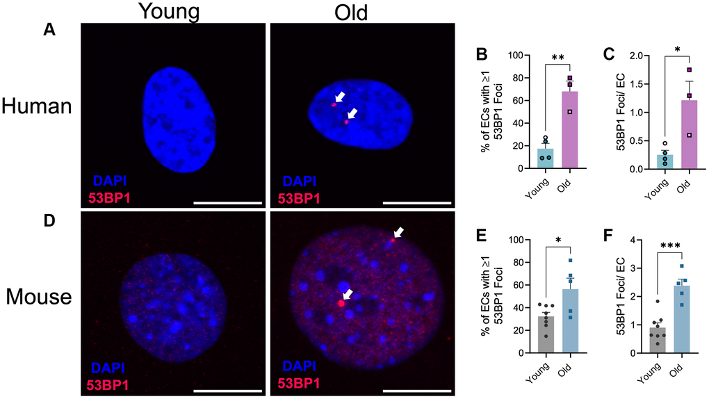 Effect of aging on endothelial cell DNA damage. (A) Representative images of immunofluorescence for the DNA damage marker 53BP1 on human microvascular lung endothelial cells from young (29 ± 1 year old, female) and old (67 ± 1 year old, female) donors. N = 3–4 experimental replicates from 2 young and 2 old donors. (B) Percentage of endothelial cells (EC) containing one or more 53BP1 foci. (C) Number of 53BP1 foci per endothelial cell. Experimental replicates on cells from the same donors are denoted by individual data points with like colors. (D) Representative images of immunofluorescence for the DNA damage marker 53BP1 on mouse microvascular lung endothelial cells from young (2.7 ± 0 mo old, male) and old (27 ± 0 mo old, male) mice. N = 5–8 experimental replicates from 12 young and 12 old mice per group. (E) Percentage of endothelial cells containing one or more 53BP1 foci. (F) Number of 53BP1 foci per endothelial cell. Individual data points with black borders denote females. Individual data points matching group colors denote males. *p **p ***p 
