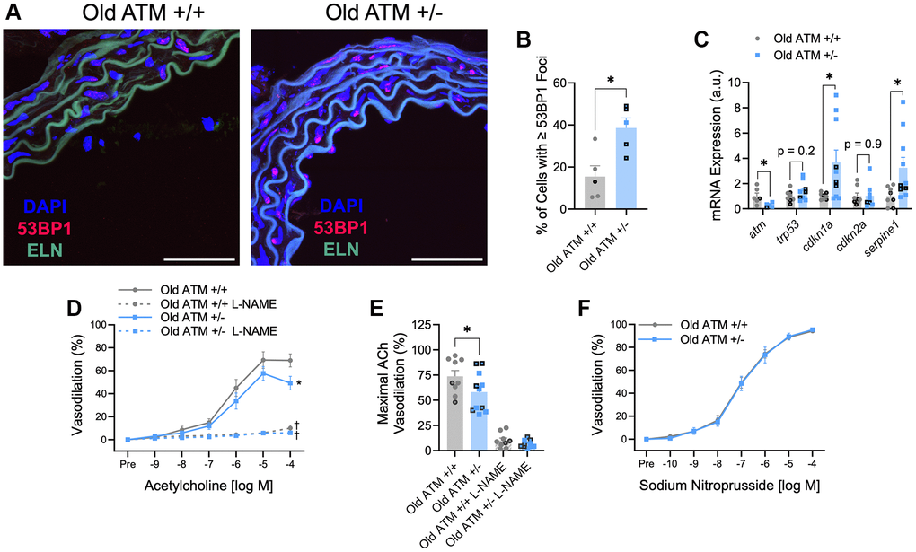 Impact of aging and reduced double-strand DNA break repair on arterial DNA damage, senescence, and endothelium-dependent and -independent vasodilation. (A) Representative images of immunofluorescence for the DNA damage marker 53BP1 performed in aortic segments of Old ATM +/+ and Old ATM+/− mice. Green is elastin (ELN) autofluorescence from tunica media. N = 4–6 per group. (B) Percentage of aortic cells containing one or more 53BP1 foci. (C) Aortic mRNA expression of atm and senescence-related genes. N = 5–10 per group. (D) Mesenteric artery dose-response curves to increasing doses of the endothelium-dependent vasodilator acetylcholine in the absence and presence of the nitric oxide synthase inhibitor L-NAME. N = 8–14 per group. (E) Maximal acetylcholine (ACh) vasodilation in mesenteric arteries in the absence and presence of L-NAME. N = 8–14 per group. (F) Mesenteric artery dose-response curves to increasing doses of the endothelium-independent vasodilator sodium nitroprusside. N = 14–16 per group. Individual data points with black borders denote female mice. Individual data points matching group colors denote male mice. *p †p 