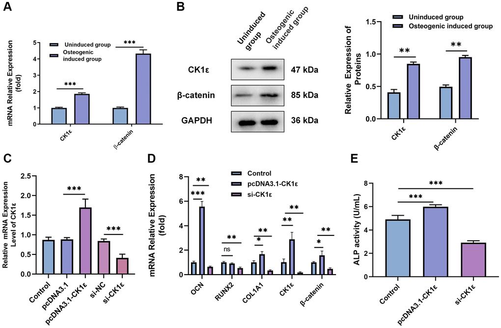 Relationship between CK1ε, β-catenin, and the OD of BMSCs. (A) Relative mRNA expressions of CK1ε and β-catenin after the OD of BMSC. (B) Western blot detection and analysis of relative CK1ε and β-catenin protein levels after two weeks’ induction. (C) qRT-PCR was used to detect the relative mRNA expression of CK1ε after transfection. (D) The relative mRNA expression levels of OD-related genes (OCN, RUNX2, SP7, and COL1A1) after CK1ε transfection. (E) ALP activity on the 14th day of BMSC’s OD with different transfections. The experiments in this figure were repeated three times, and similar results were obtained. The data are presented as the means ± SD of independent experiments. The Student’s t-test was used for (A, B) and one-way ANOVA was used for (C–E). *P **P ***P 