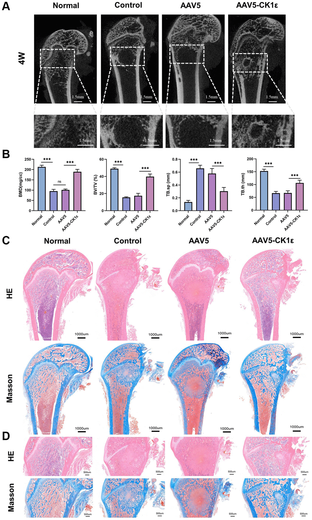 New bone morphology and histological analysis of new bone formation. (A) Micro-CT images of rats four weeks after surgery, and regional enlargement of the defect area. (B) Comparative quantitative and statistical analysis of BMD, BV/TV, TB.sp, and TB.th. (n = 5) (C). Defects of femoral condyle were stained with H&E and Masson’s stain four weeks after surgery. (D) Enlarged H&E and Masson’s stained images four weeks after surgery. The one-way ANOVA was used for B. *P **P ***P 