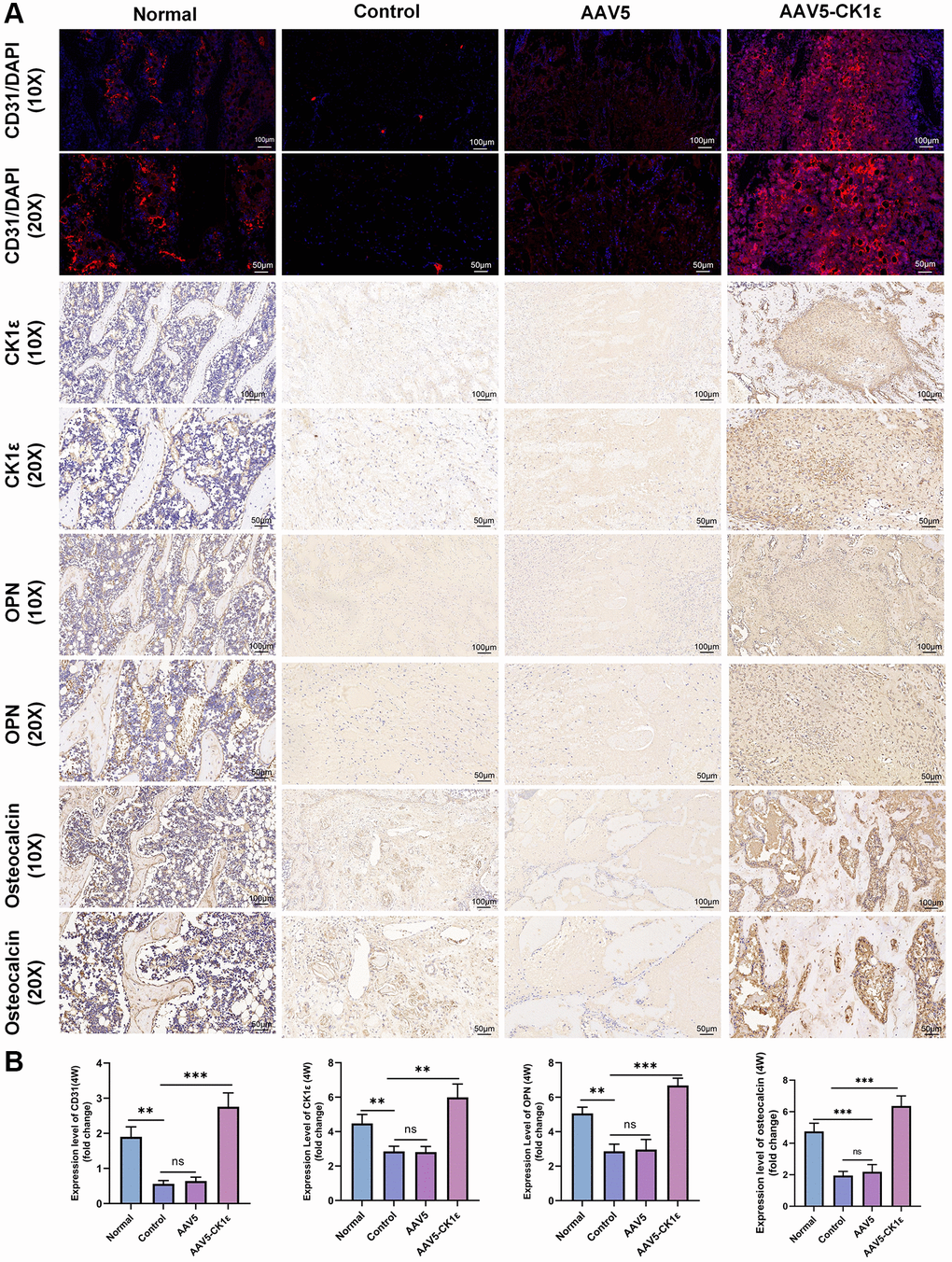 Results of immunofluorescence and immunohistochemical staining and semi-quantitative analysis of femoral condylar defects. (A) Images of CD31 immunofluorescence staining and immunohistochemistry of CK1ε, OPN, and osteocalcin 4 weeks after surgery. (B) Semi quantitative analysis results of immunofluorescence and immunohistochemistry (n = 5), using ImageJ software. The one-way ANOVA was used for B. *P **P ***P 