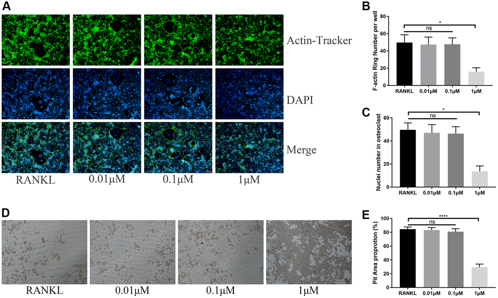 ICT suppresses osteoclast function. (A) Representative images of F-actin rings. (B) Quantification of the F-actin rings number. (C) Mean number of nuclei in each cell. (D) Representative images of pit area by ICT-treated osteoclast on Osseo Assay plate. (E) Quantification of pit area. All data were presented as mean ± SD, n = 3. Abbreviation: ns: not statistical significance; *P ****P 