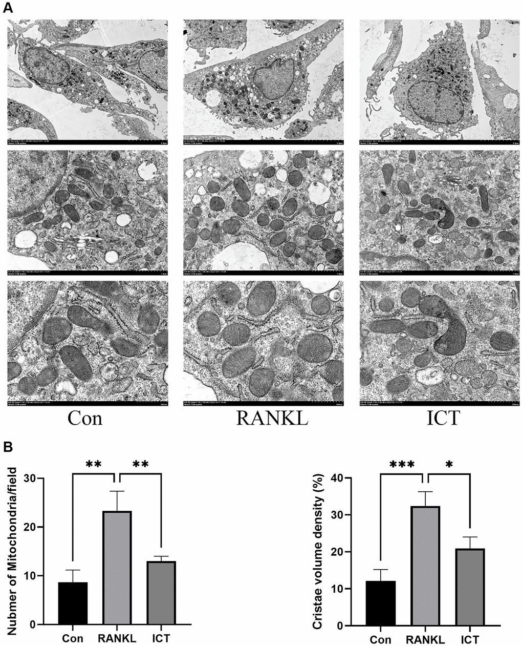 Representative images of ultrastructural analysis of mitochondria during osteoclast differentiation. (A) Representative image of mitochondria. (B) The quantitative analysis of mitochondria number and cristae density. All data were presented as mean ± SD, n = 3, *P **P ***P 