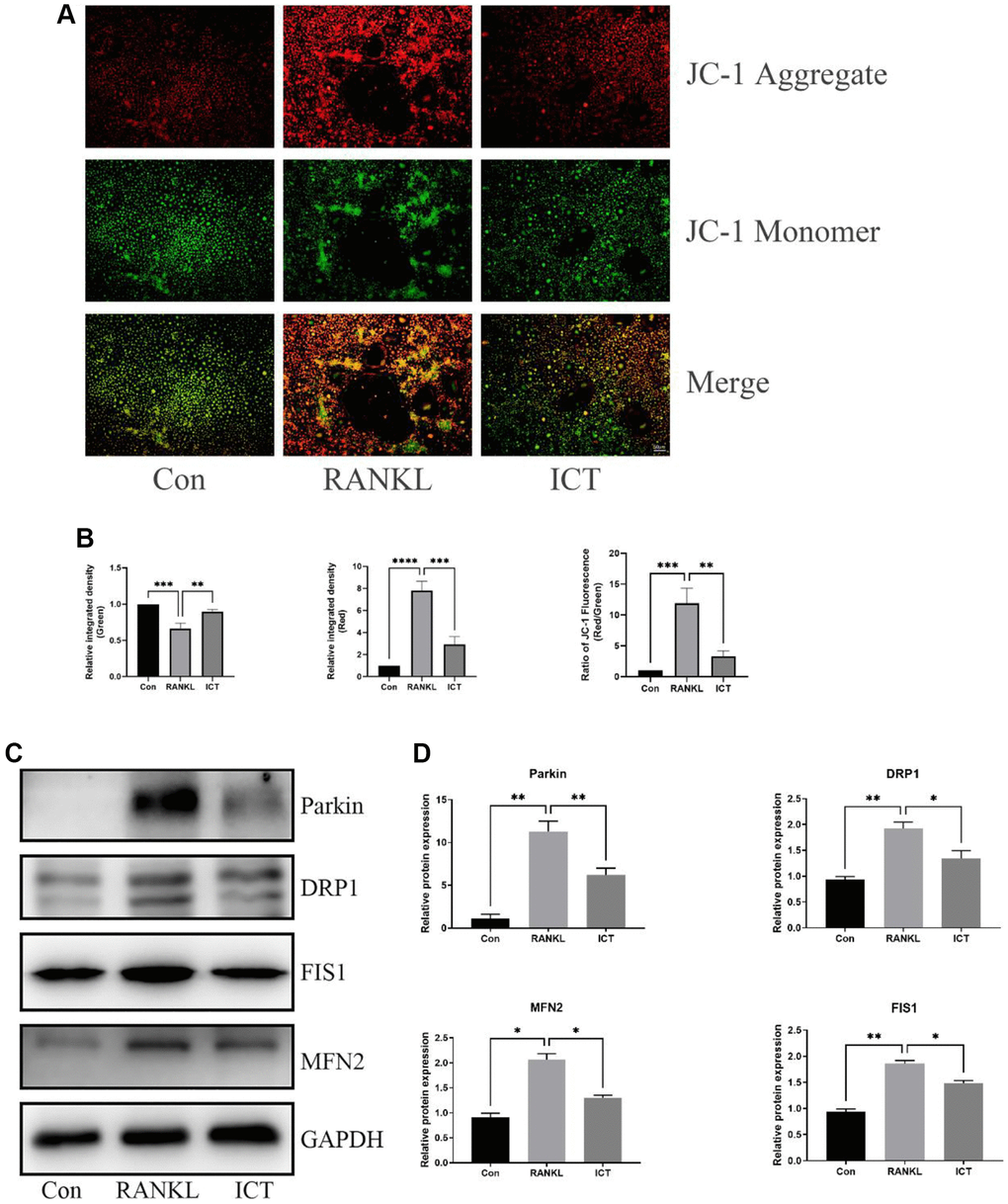 ICT inhibited the mitochondrial membrane potential and reduced mitochondrial fusion and fission. (A) Representative fluorescence photographs of mitochondrial membrane potential stained by JC-1. (B) Quantitative analysis of membrane potential by measuring the ratio of red and green fluorescence intensity. (C) Representative protein bands of Parkin, DRP1, FIS1, and MFN2. (D) Quantitative analysis of Parkin, DRP1, FIS1, and MFN2. All data were presented as mean ± SD, n = 3, *P **P ***P ****P 