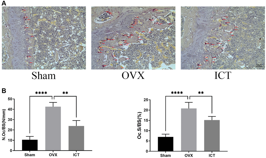 ICT inhibits osteoclast formation in vivo. (A) Representative TRAP staining images of femurs from each group. (B) The quantitative histomorphometric analysis of TRAP-positive osteoclasts, N.Oc/BS and OcS/BS. All data were presented as mean ± SD, n = 6, **P ****P 