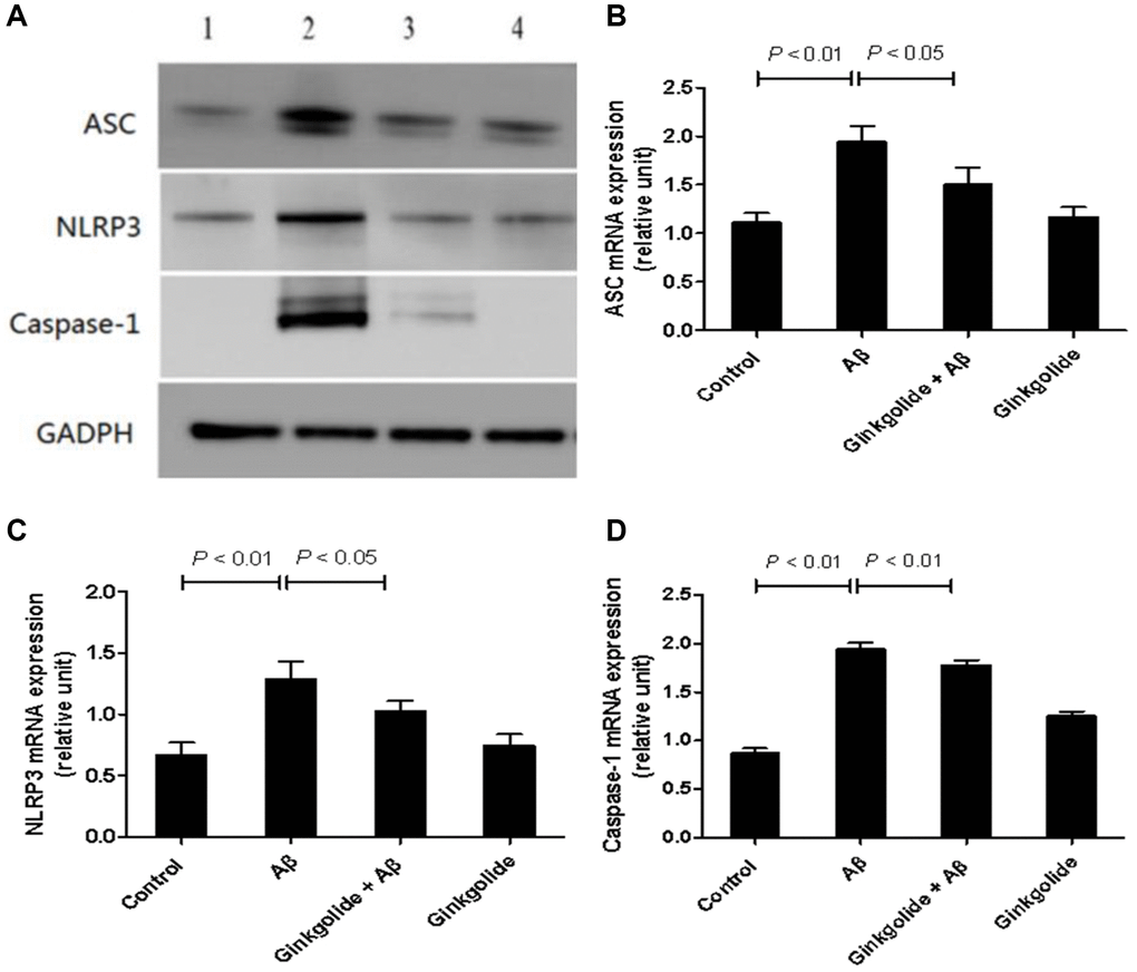 Detection of intracellular protein expression of ASC, NLRP3, and caspase-1 in BV-2 cells by western blotting. (A) Western blotting. Lane 1, control group (untreated); lane 2, Aβ group (treated with 2 μM Aβ1–42 for 12 h); lane 3, ginkgolide + Aβ group (pretreated with 25 μg/ml ginkgolide for 2 h followed by 2 μM Aβ1-42 for 10 h); lane 4, ginkgolide group (pretreated with 25 μg/ml ginkgolide for 12 h). (B–D) Effects of ginkgolide on intracellular protein expression of ASC, NLRP3, and caspase-1 in BV-2 cells. Data are presented as mean ± standard deviation. Abbreviations: Aβ: amyloid beta; ASC: apoptosis-associated speck-like protein containing a CARD; NLRP3: nucleotide-binding oligomerization domain-like receptor family pyrin domain-containing 3.