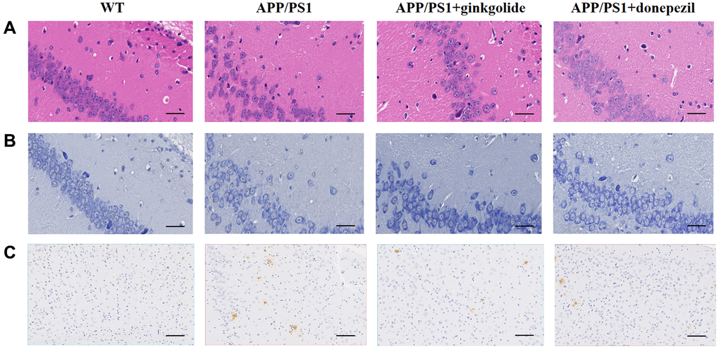 Ginkgolides attenuated pathological alterations in the hippocampus and cerebral cortex of APP/PS1 mice. Ginkgolides alleviated (A) inflammatory cell infiltration (H&E, ×400, scale bar = 50 μm), (B) neuron loss (Nissl staining, ×400, scale bar = 50 μm), and (C) the accumulation of Aβ in the brains of APP/PS1 mice shown by immunohistochemistry (×200; scale bar = 50 μm). Abbreviations: Aβ: amyloid beta; APP/PS1: amyloid precursor protein/presenilin 1; H&E: Hematoxylin and Eosin; WT: wild-type.