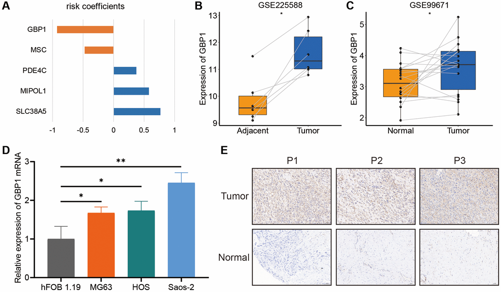 The expression levels of GBP1. (A) The coefficients of the five model genes. (B, C) The GBP1 expression level in osteosarcoma and non-tumoral paired samples, based on the GSE99671 and GSE225588 cohort. (D) The qRT-PCR result of GBP1 in hFOB 1.19, MG63, HOS, Saos-2 cell lines. (E) The expressions of GBP1 in tumor and adjacent normal tissues. *P **P ***P 