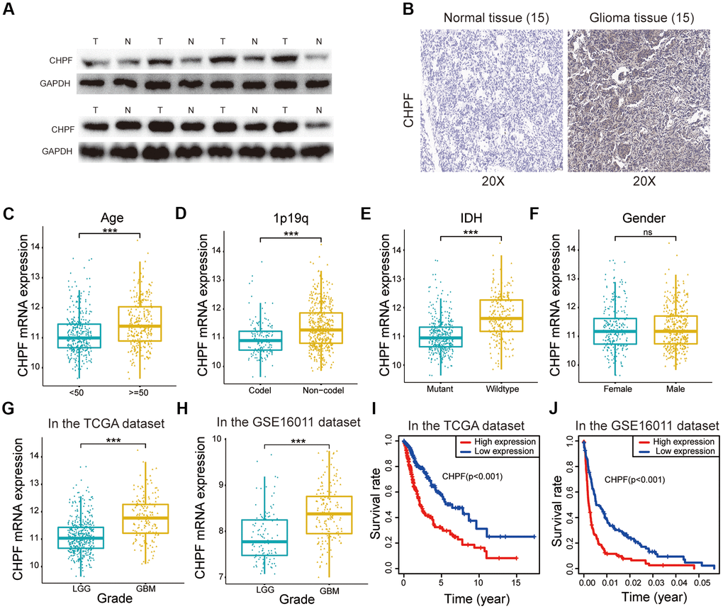 CHPF was upregulated in glioma and served as a prognostic factor. (A, B) The expression of CHPF in gliomas and NBTs was detected by WB and IHC assays. (C–F) Correlations between the CHPF expression and different clinical characteristics of glioma in the TCGA dataset. (G, H) Correlation between the CHPF expression and grade of patients in the TCGA and GSE16011 datasets. (I, J) Correlation between CHPF expression and the survival rate of glioma patients was analyzed by the KM curves in TCGA and GSE16011 datasets. ns P > 0.05, * P 