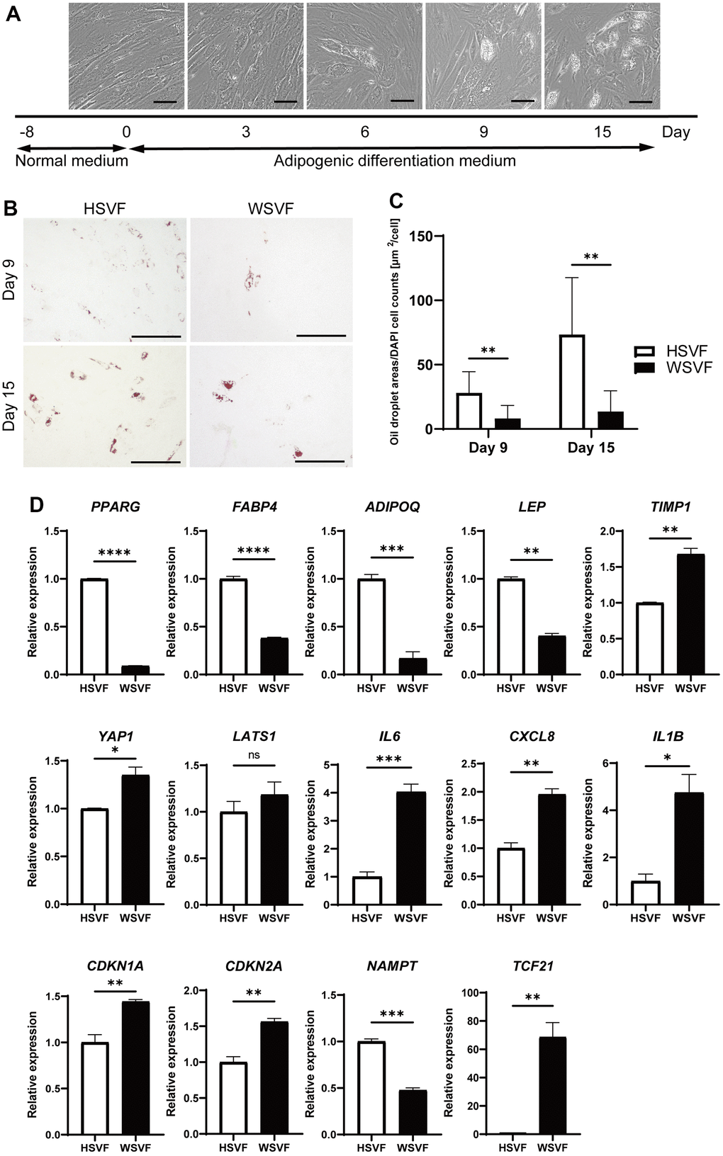 Adipogenesis is suppressed in WS. (A) Schematic illustration of the adipogenesis experiment. Representative images on days 0, 3, 6, 9, and 15. Scale bar, 100 μm. (B) Representative images of Oil Red O staining on days 9 and 15 after adipogenesis in HSVF and WSVF. Scale bar, 300 μm. (C) Quantification of the oil droplet area based on DAPI cell counts. Data are presented as means ± S.E.M. from nine different microscopic views. For statistical analysis, student t-test was performed (**p D) Quantitative real-time polymerase chain reaction of the relative gene expression during adipogenesis of three technical replicates. For statistical analysis, student t-test was performed (ns, not significant; *p p p 