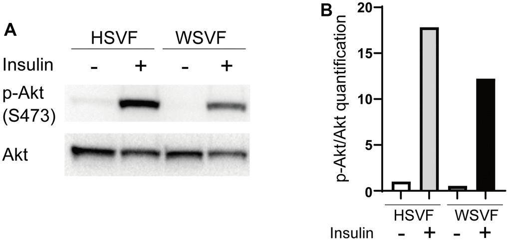 Insulin signaling is decreased in WS. (A) Western blotting of p-Akt (S473) and Akt for HSVF and WSVF. (B) Quantitative analysis of p-Akt/Akt. WS: Werner syndrome; SVF: stromal vascular fraction; HSVF: SVF derived from a healthy patient; WSVF: SVF derived from a patient with WS.