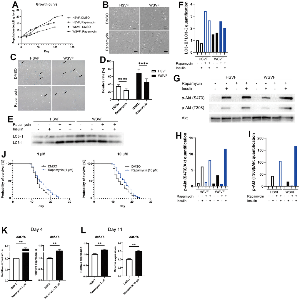 Rapamycin alleviates cellular senescence in SVF. (A) Growth curves of HSVF and WSVF treated with rapamycin. (B) Morphological changes of the SVFs treated with rapamycin. Scale bar, 100 μm. (C) Representative images of SA-β-gal staining of the SVFs treated with rapamycin. Black arrows indicate SA-β-gal-positive cells. Scale bar, 100 μm. (D) Quantification of SA-β-gal-positive cells. Data are presented as means ± S.E.M. from nine different microscopic views. For statistical analysis, student t-test was performed (****p E) Western blotting of the protein expression of LC3-I and LC3-II in HSVF and WSVF. (F) Quantification of (E). (G) Western blotting of p-Akt (S473), p-Akt (T308), and Akt in HSVF and WSVF treated with rapamycin. (H) Quantitative analysis of p-Akt (S473)/Akt. (I) Quantitative analysis of p-Akt (T308)/Akt. (J) Survival probability of WRN-knockout C. elegans (gk99) treated with 1 μM and 10 μM of rapamycin. For statistical analysis, log-rank (Mantel-Cox) test was performed; **p p K, L) Quantitative real-time polymerase chain reaction of the relative expression of daf-16 on days 4 and 11 in gk99 treated with 1 μM and 10 μM of rapamycin. Data are presented as means ± S.E.M. of three technical replicates. For statistical analysis, student t-test was performed (**p 