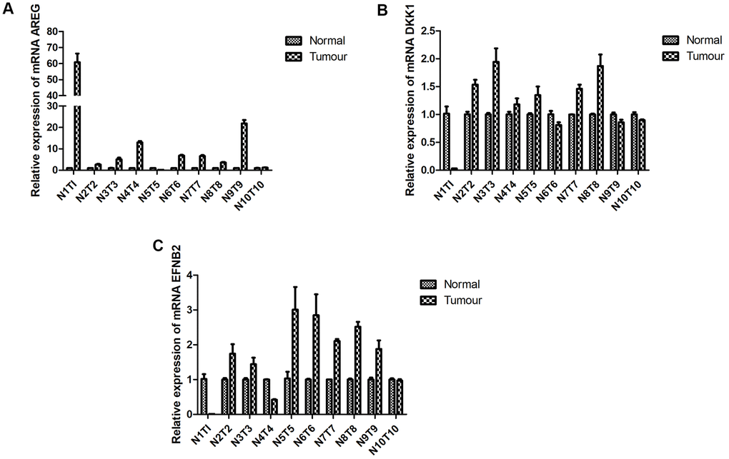 RT-qPCR. Expression of prognostic-specific genes in HNSCC were consistent with the predicted trend. RT-qPCR detected mRNA expression levels of (A) AREG, (B) DKK1, and (C) EFNB2 in the tumor tissue and adjacent tissue of patients with HNSCC p 